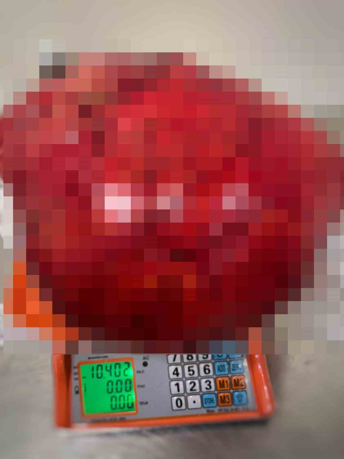 Görenler kilo aldı sandı, karnından 30 santim uzunluğunda 10,5 kiloluk kitle çıktı
