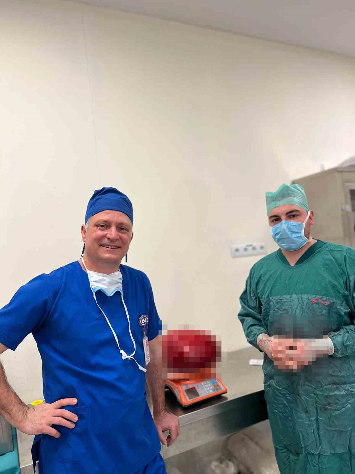 Görenler kilo aldı sandı, karnından 30 santim uzunluğunda 10,5 kiloluk kitle çıktı
