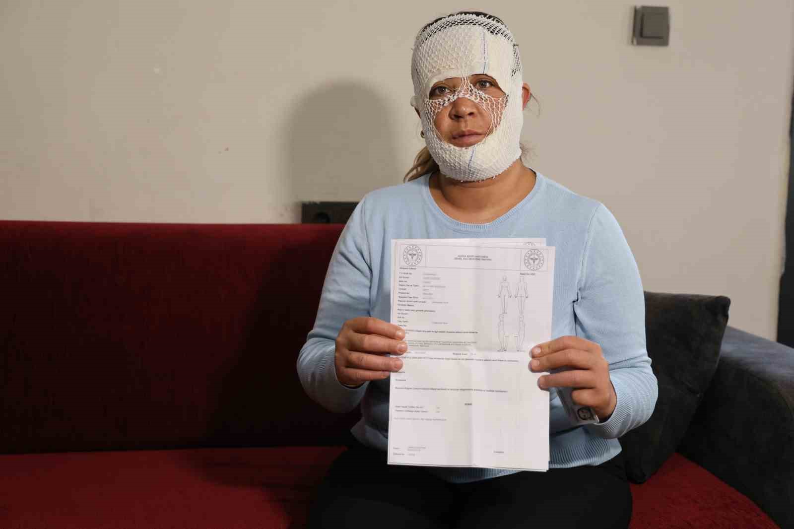 Güzelleşmek uğruna gittiği merkezde yüzü yandı
