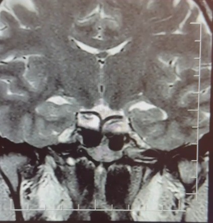 Hamileyim diye geldi, tümör teşhisi konuldu
