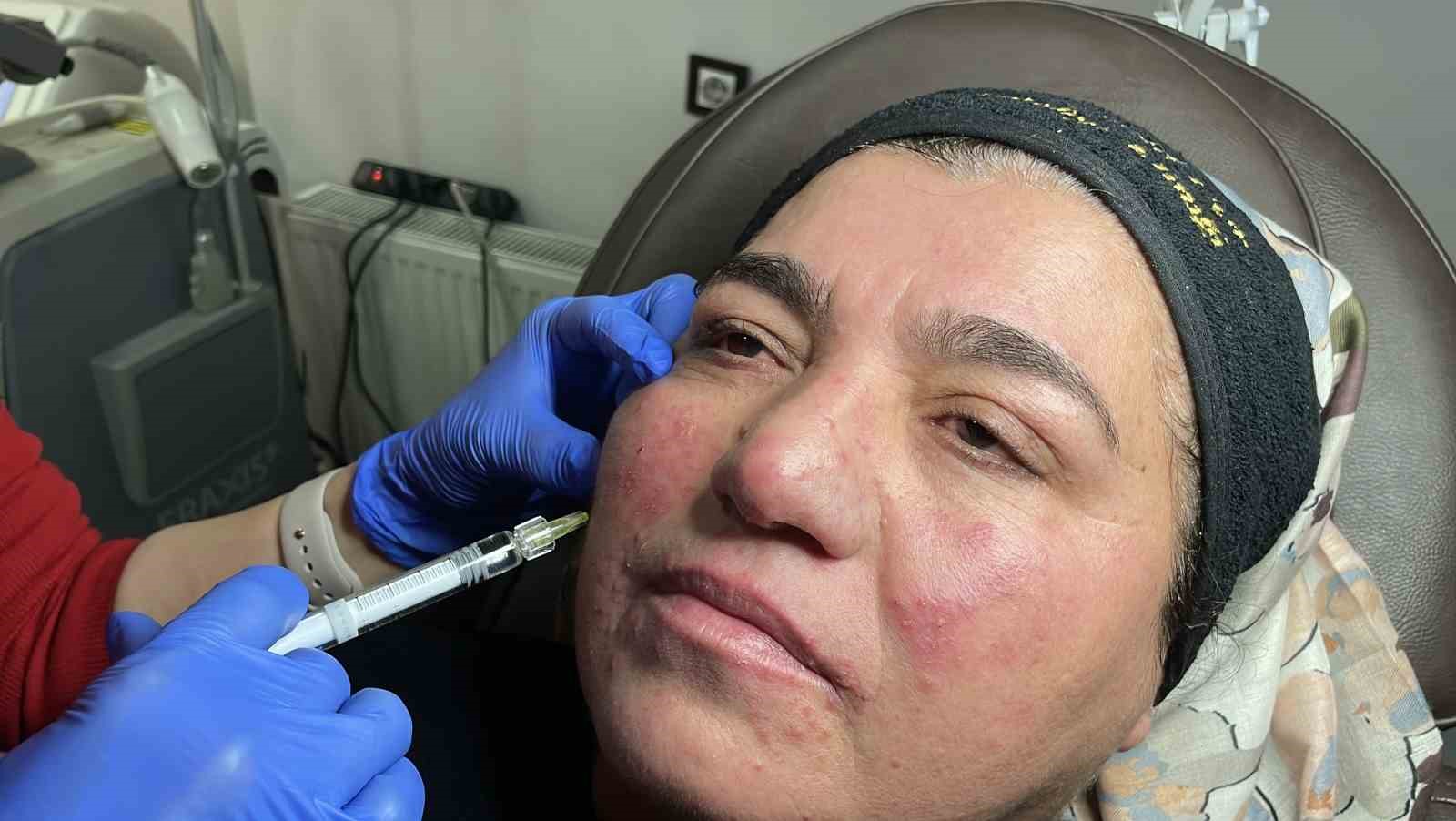 Hastalığı yüzünden yıllarca evden çıkamadı, şimdi ise çekinmeden çıkabiliyor
