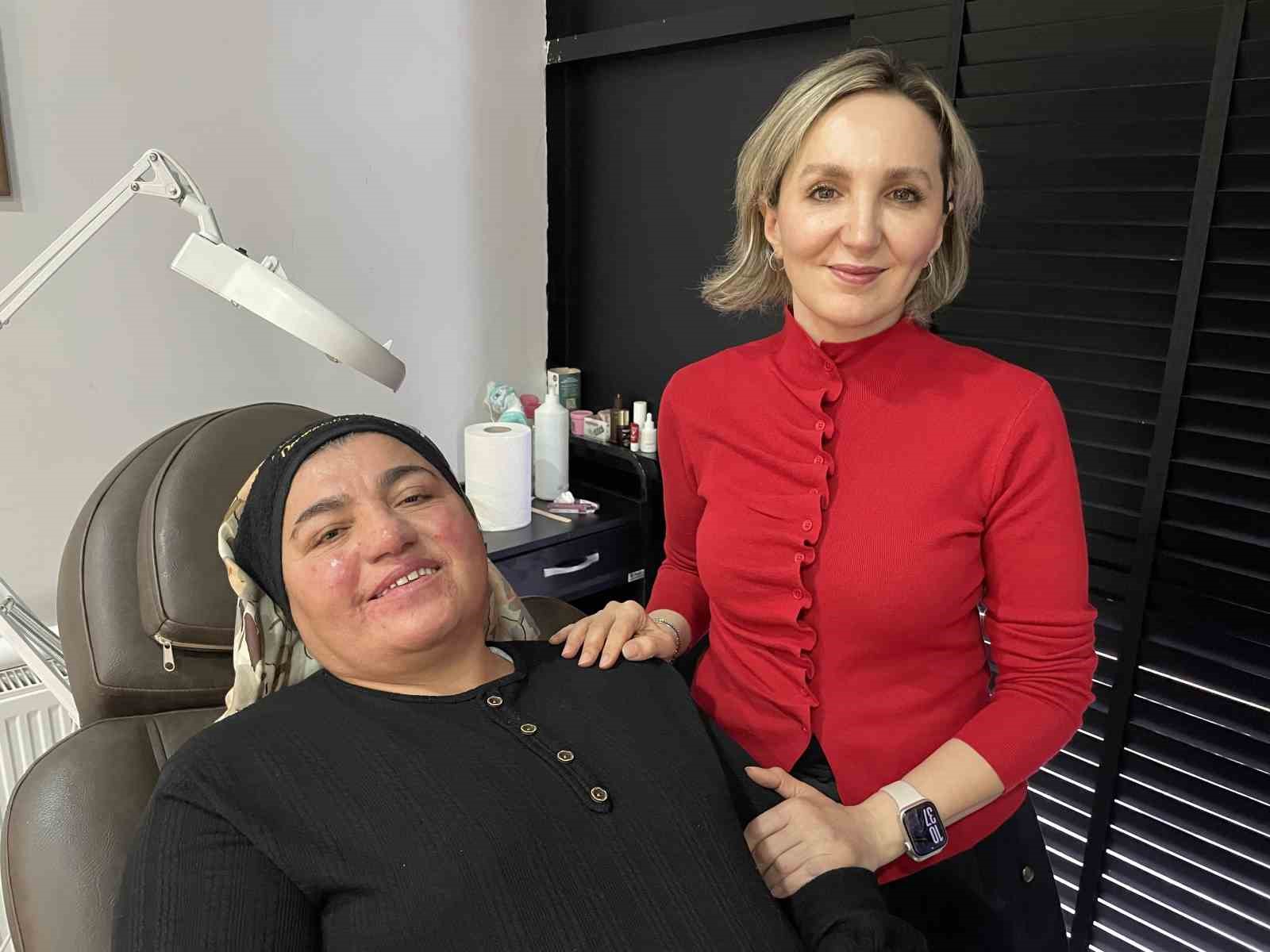 Hastalığı yüzünden yıllarca evden çıkamadı, şimdi ise çekinmeden çıkabiliyor
