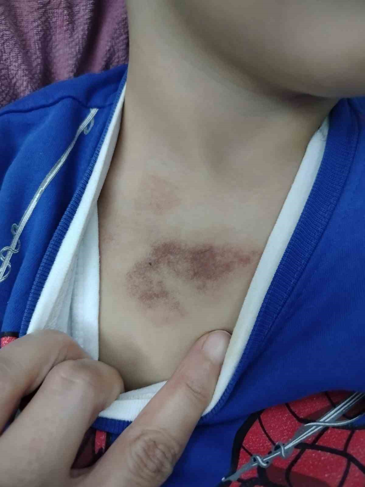 İBB kreşinde istismar ve darp iddiası: Çocukları tacize uğrayan aile şikayetçi oldu
İBB kreşinde istismar ve darp iddiası: Çocukları tacize uğrayan aile şikayetçi oldu