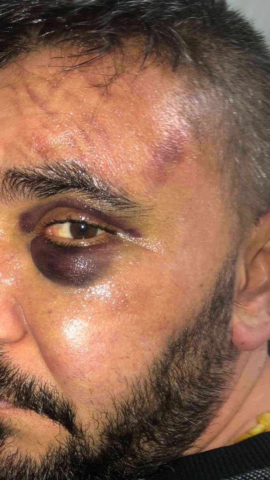 İsyeri sahibi dükkanında öldüresiye darp edildi
