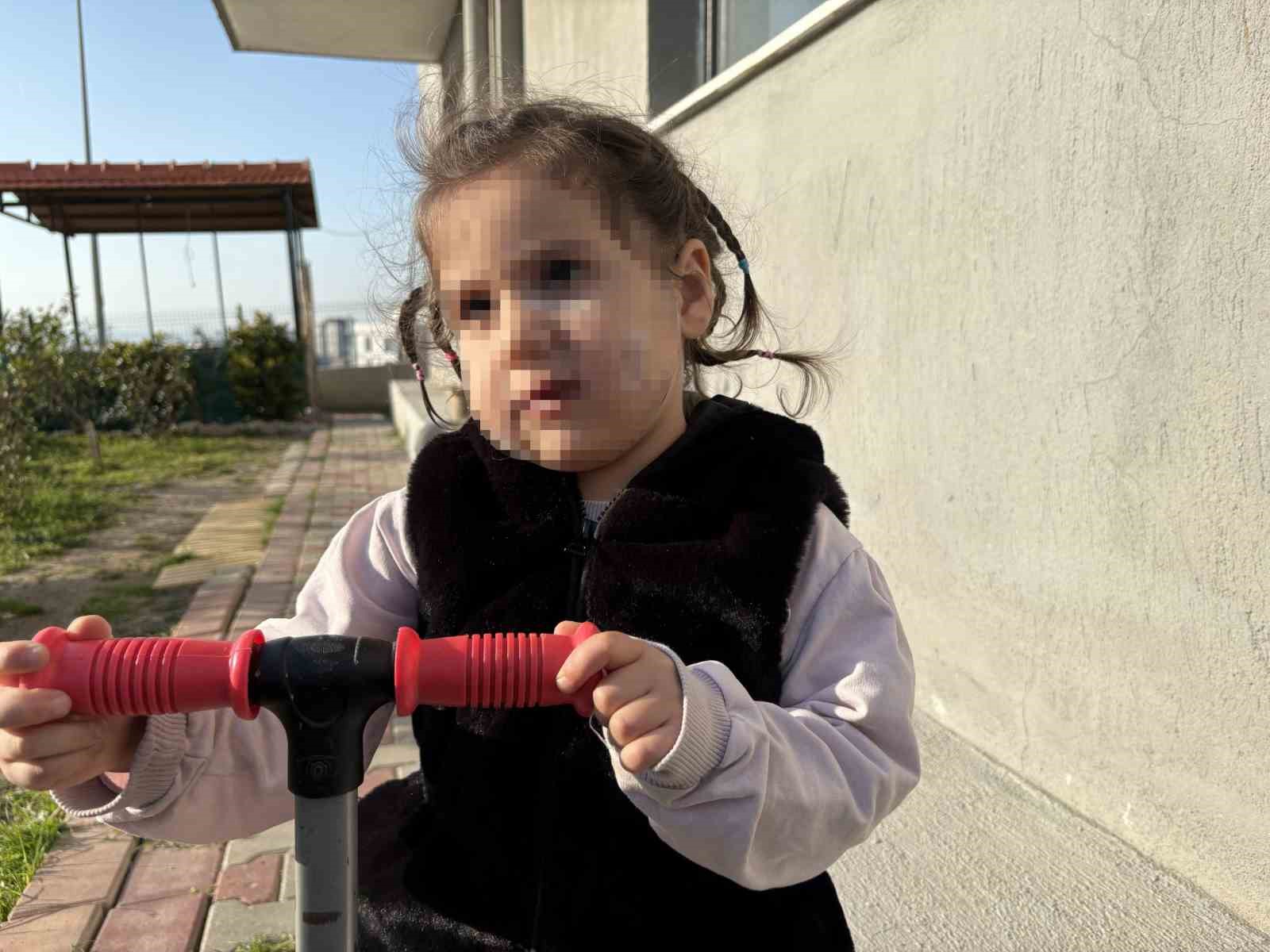 İzmir’de köpek dehşeti: 3 yaşındaki Ada’nın yüzü pençe ve ısırıkla dolu
