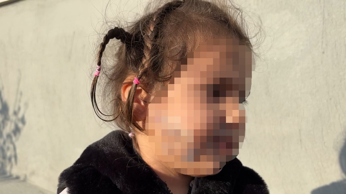 İzmir’de köpek dehşeti: 3 yaşındaki Ada’nın yüzü pençe ve ısırıkla dolu
