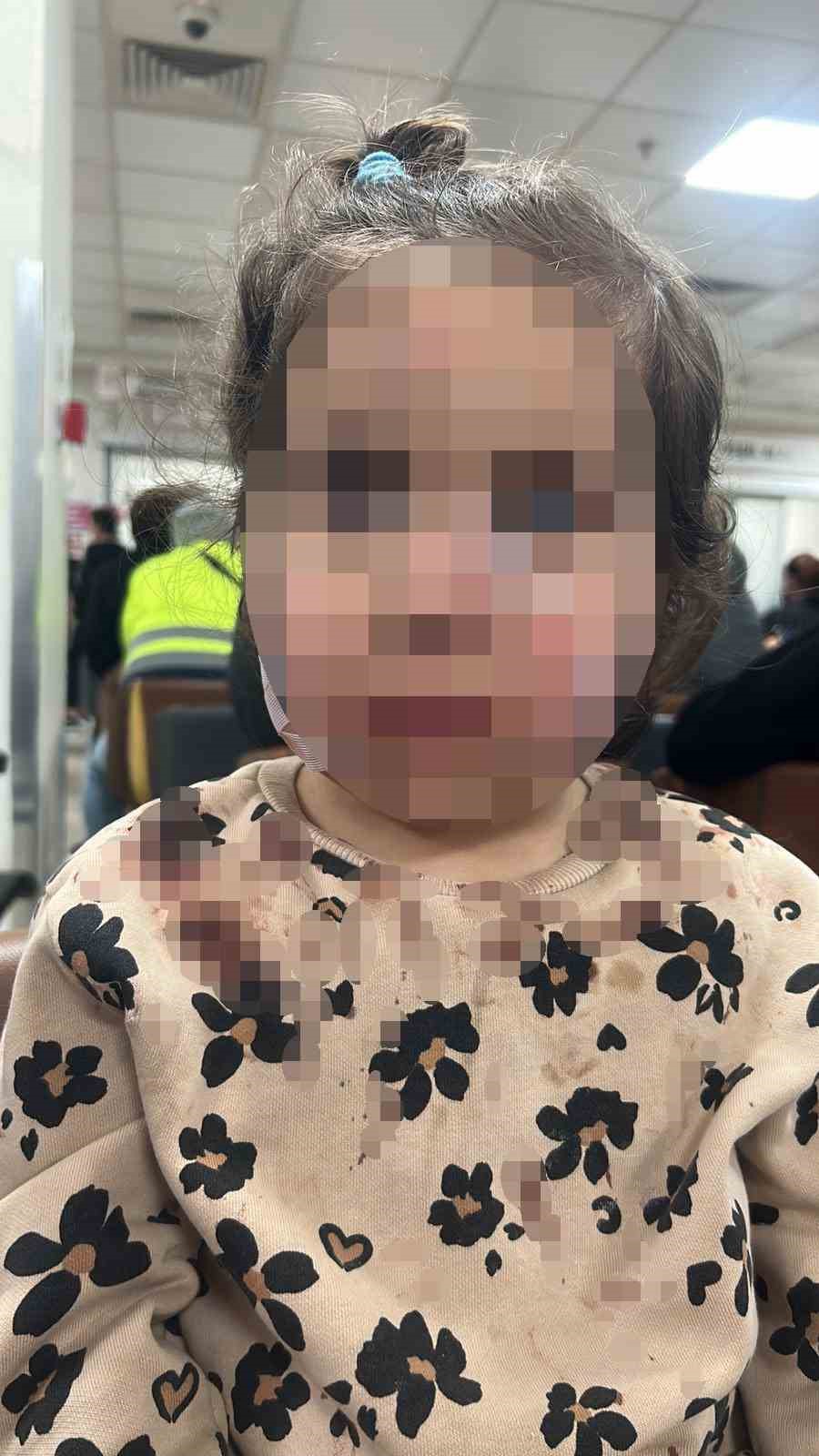 İzmir’de köpek dehşeti: 3 yaşındaki Ada’nın yüzü pençe ve ısırıkla dolu
