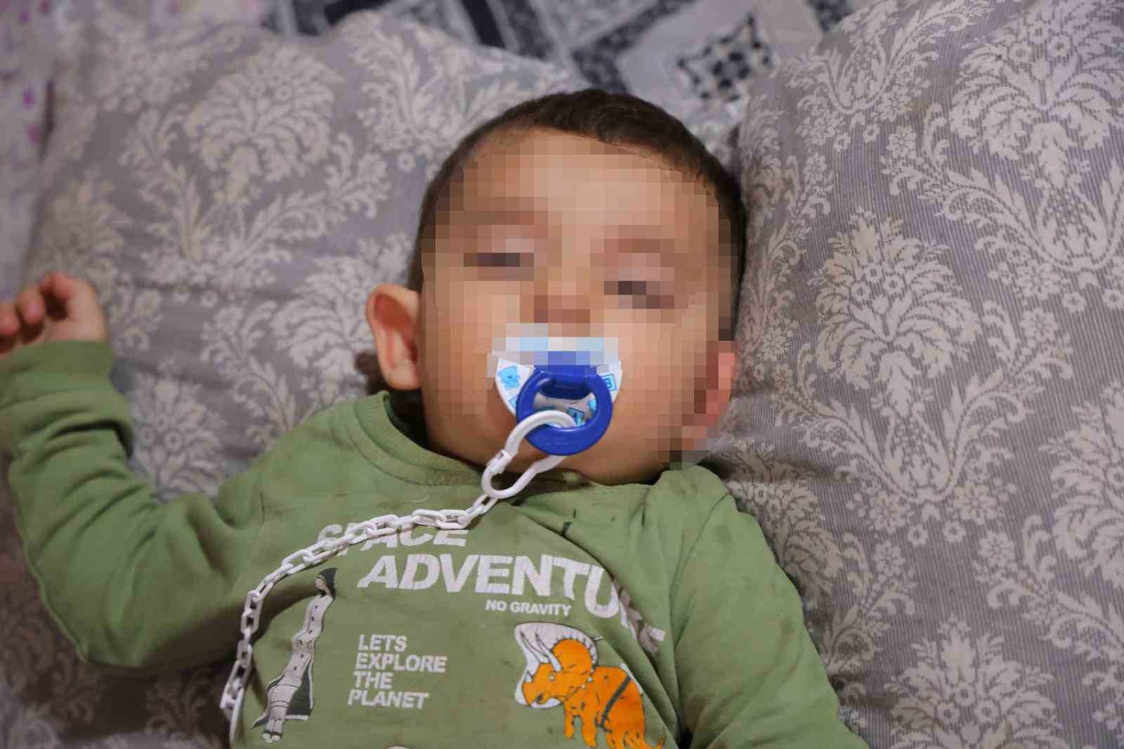 Kahramanmaraş’ta belinden zımba teli çıkan bebeğin ailesi sorumluların ceza almasını istedi
