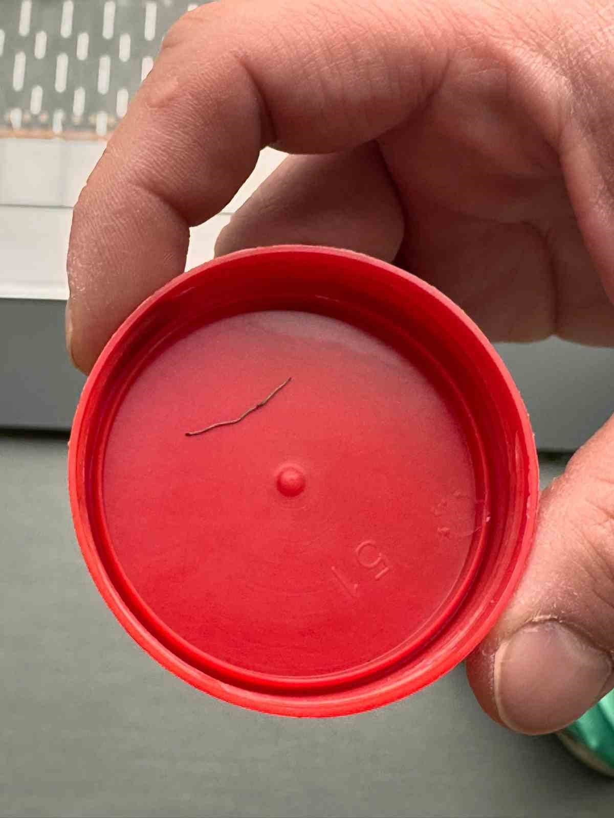 Kahramanmaraş’ta belinden zımba teli çıkan bebeğin ailesi sorumluların ceza almasını istedi
