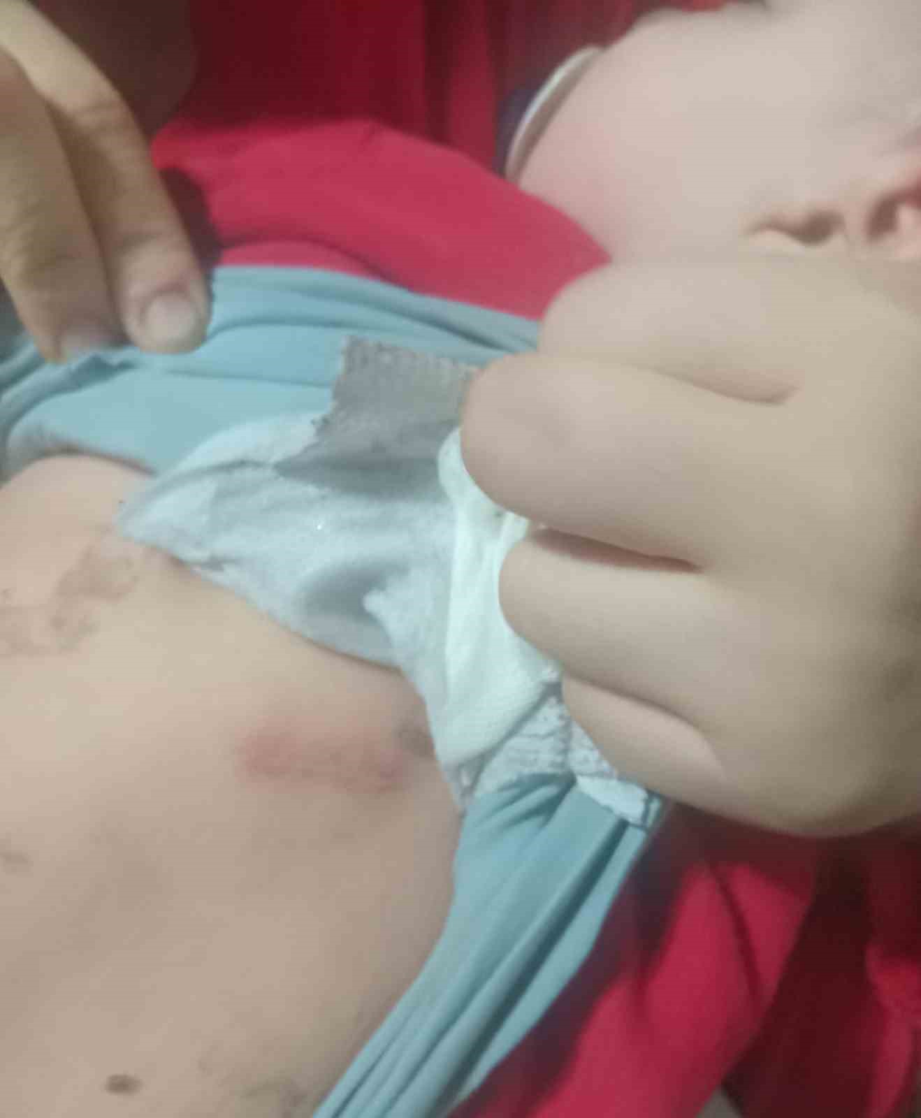 Kahramanmaraş’ta belinden zımba teli çıkan bebeğin ailesi sorumluların ceza almasını istedi
