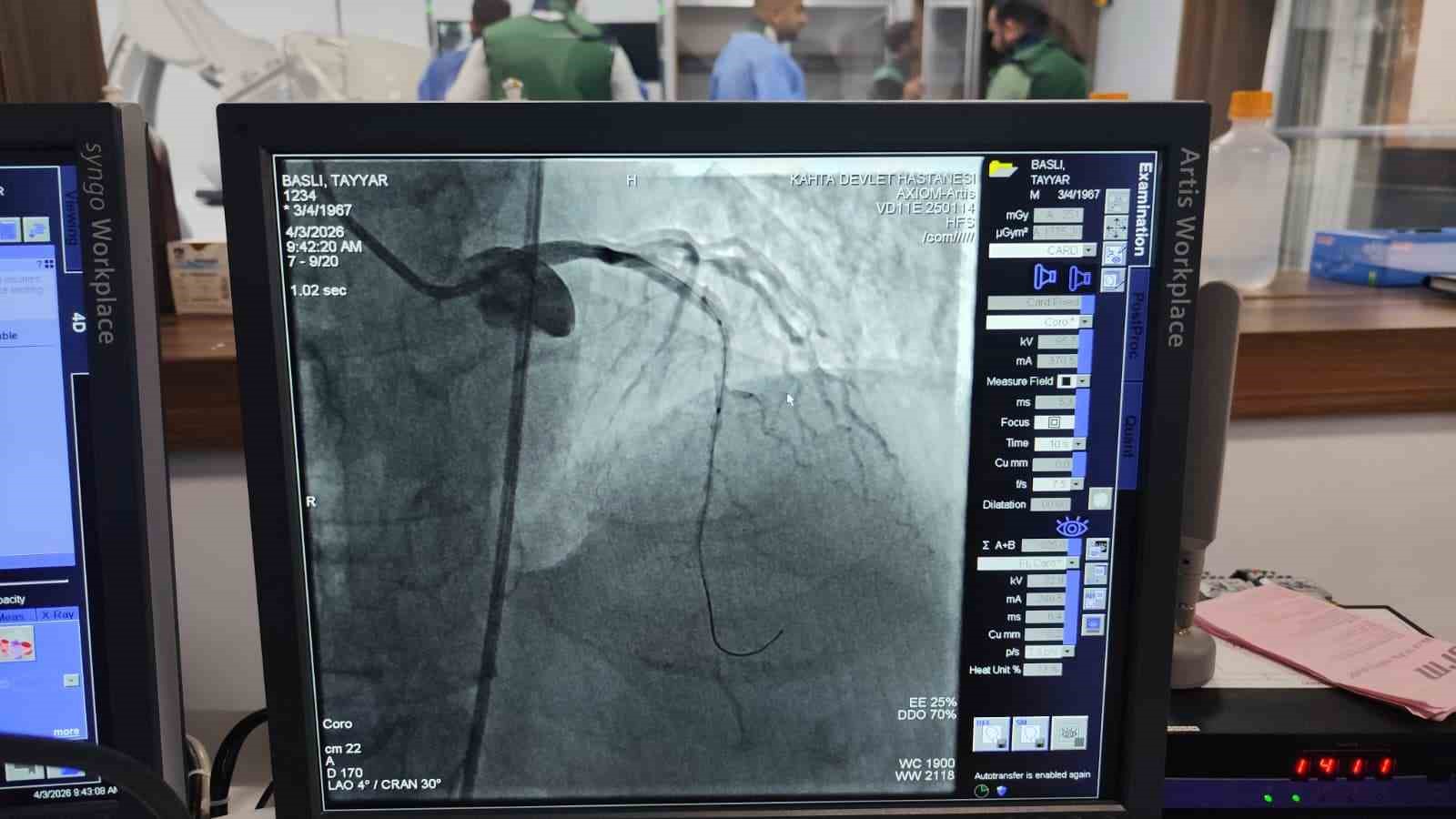 Kahta’da açılan anjiyo ünitesinde ilk hasta başarıyla tedavi edildi
