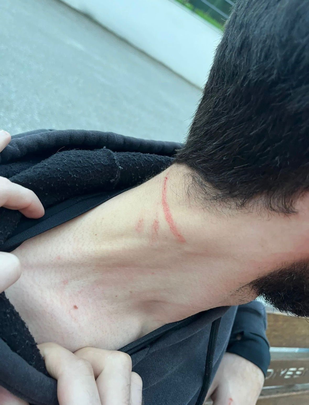 Kartepe’deki kavganın en büyük mağduru çocuklar oldu: "Babama 5 kişi saldırdılar, kafasını ATV’ye vurdular"
Kartepe’deki kavganın en büyük mağduru çocuklar oldu: "Babama 5 kişi saldırdılar, kafasını ATV’ye vurdular"