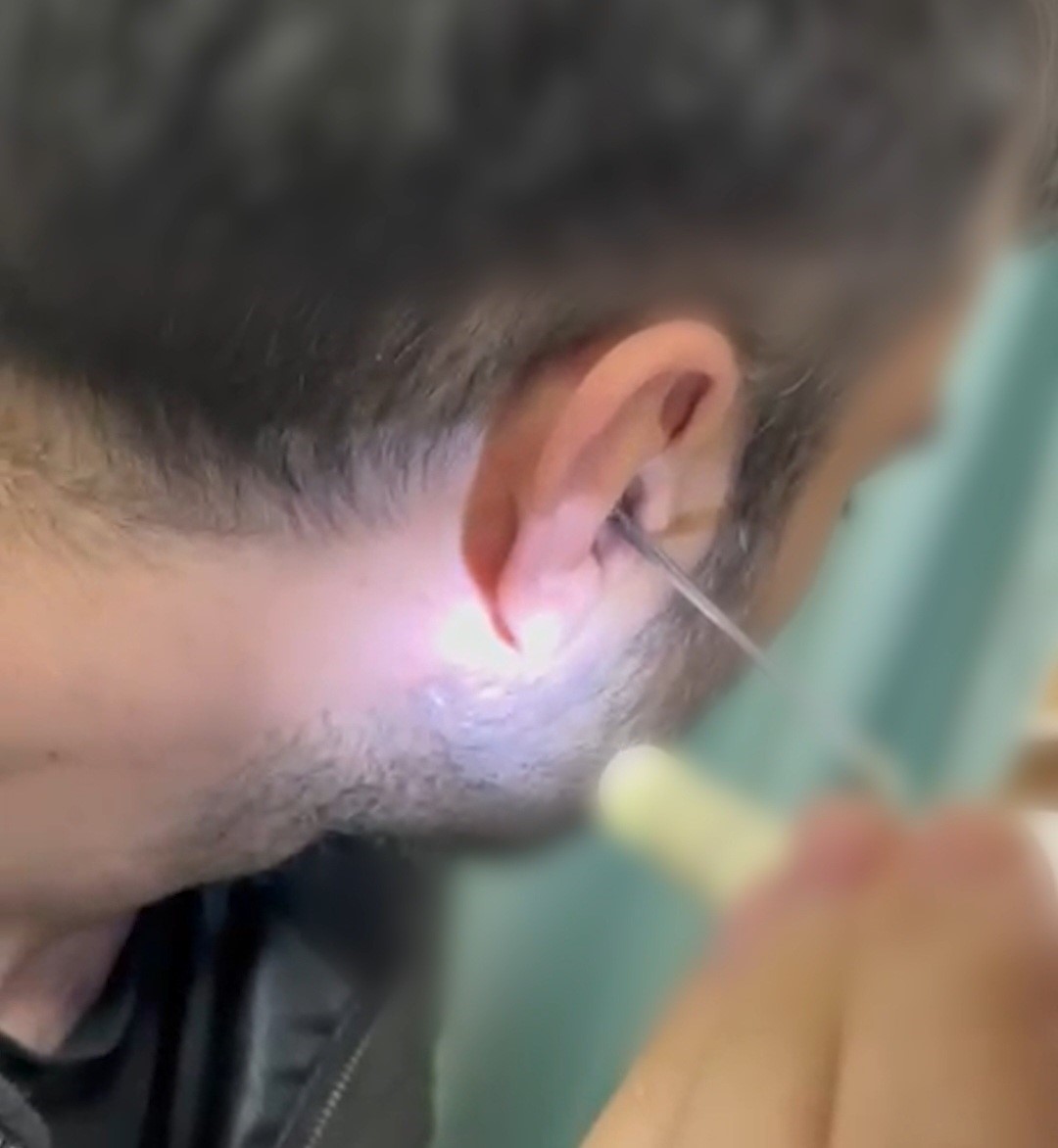 Kayseri’de kulağının içine uyuşturucu saklayan şüpheli yakalandı
