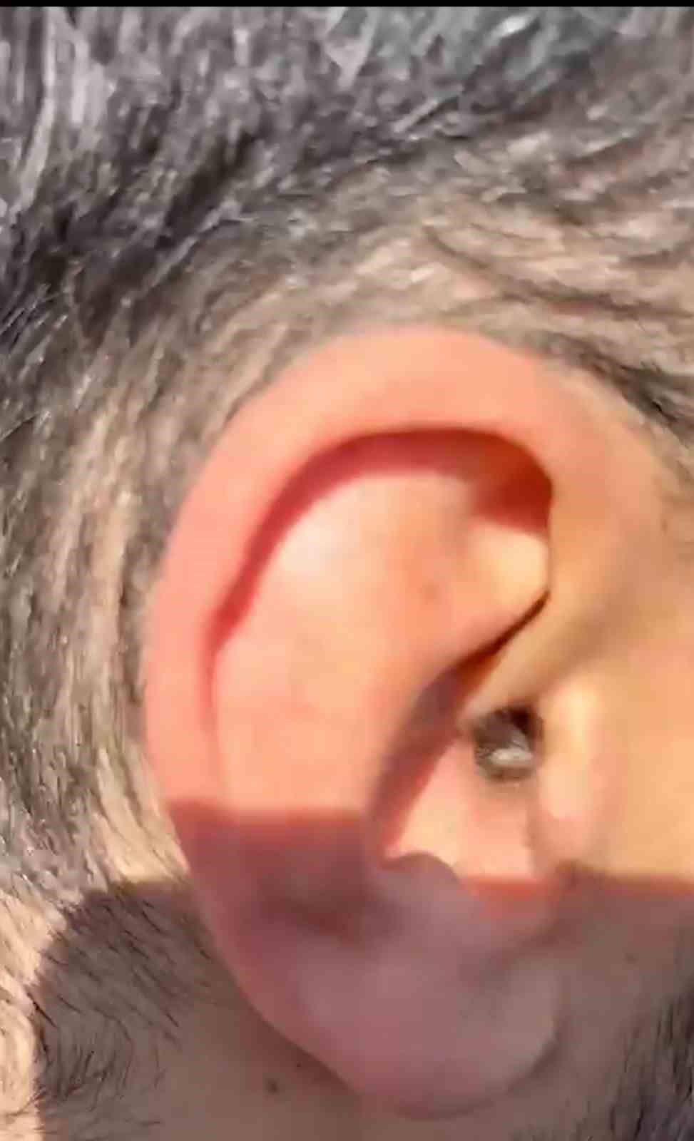 Kayseri’de kulağının içine uyuşturucu saklayan şüpheli yakalandı
