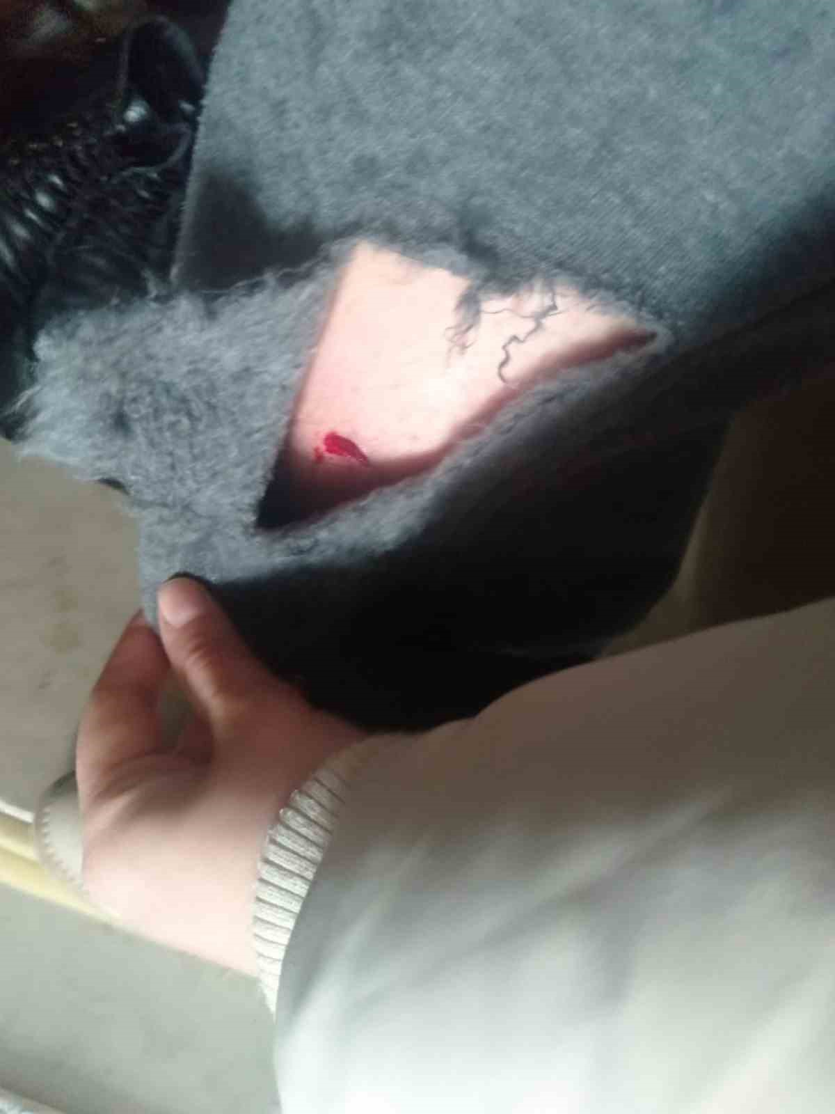 Kayseri’de sokak köpeğinin saldırısına uğrayan çocuk yaralandı
