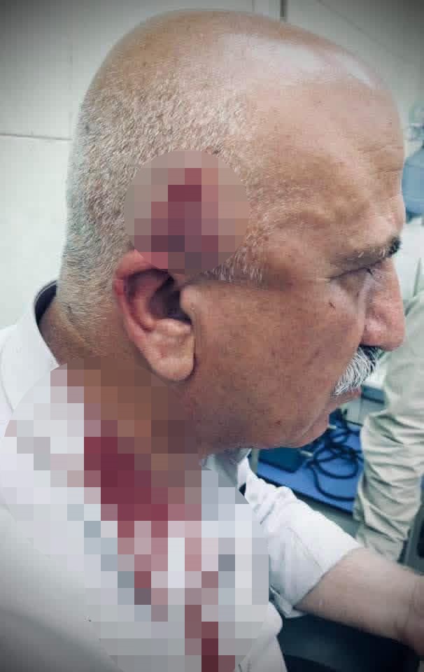 Kerkük’te kaçak yapı yıkımı sırasında kaymakama bıçaklı ve sopalı saldırı
