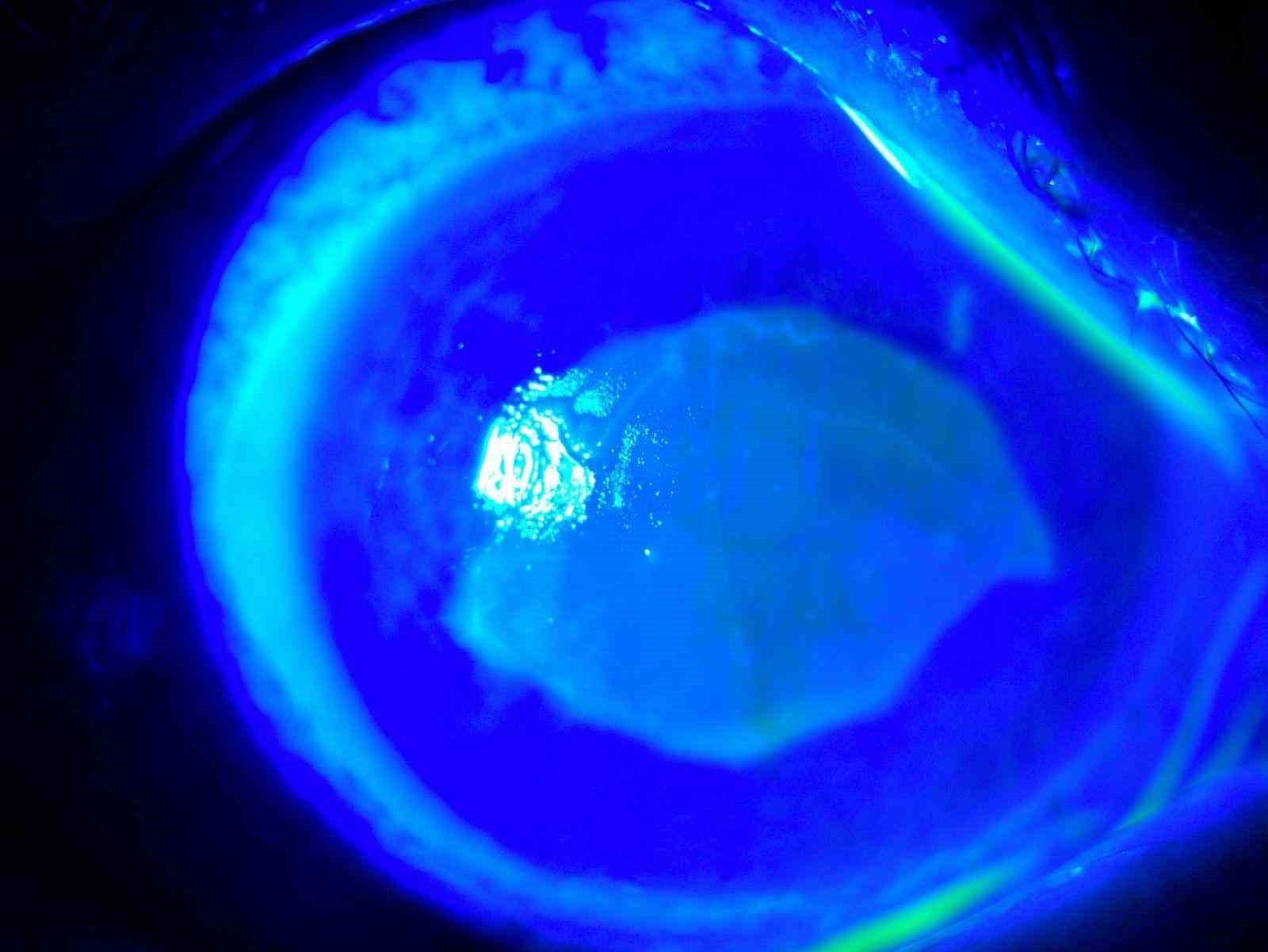 ’Kırlangıç otu kullanımı’na dikkat, uzmanlar uyarıyor: "Gözlerine suyunu damlattı, göremez hale geldi"
’Kırlangıç otu kullanımı’na dikkat, uzmanlar uyarıyor: "Gözlerine suyunu damlattı, göremez hale geldi"