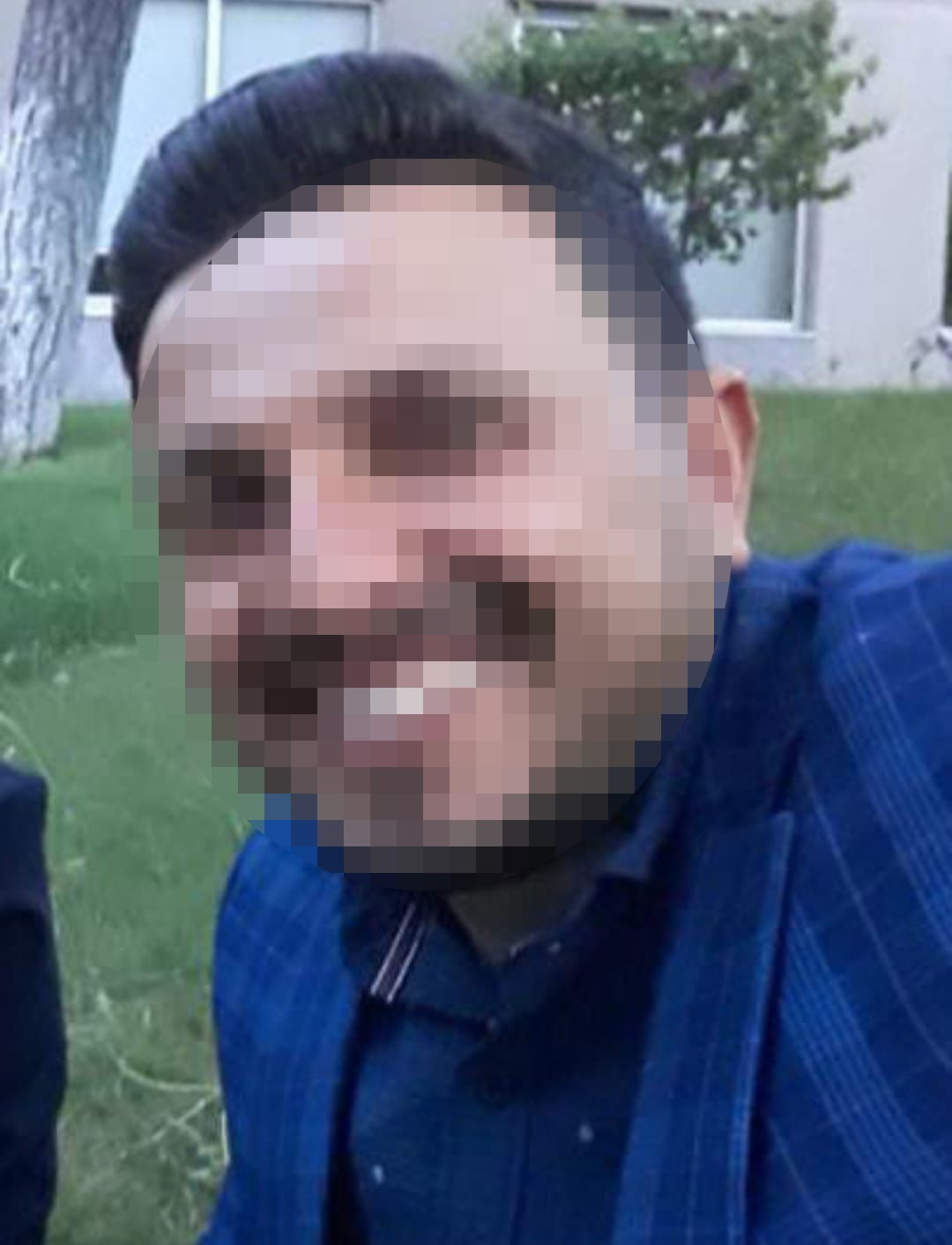 Kocasının öldüresiye darp ettiği kadın dehşet anlarını anlattı: "Yoldan geçen vatandaş olmasaydı ölmüştüm"
