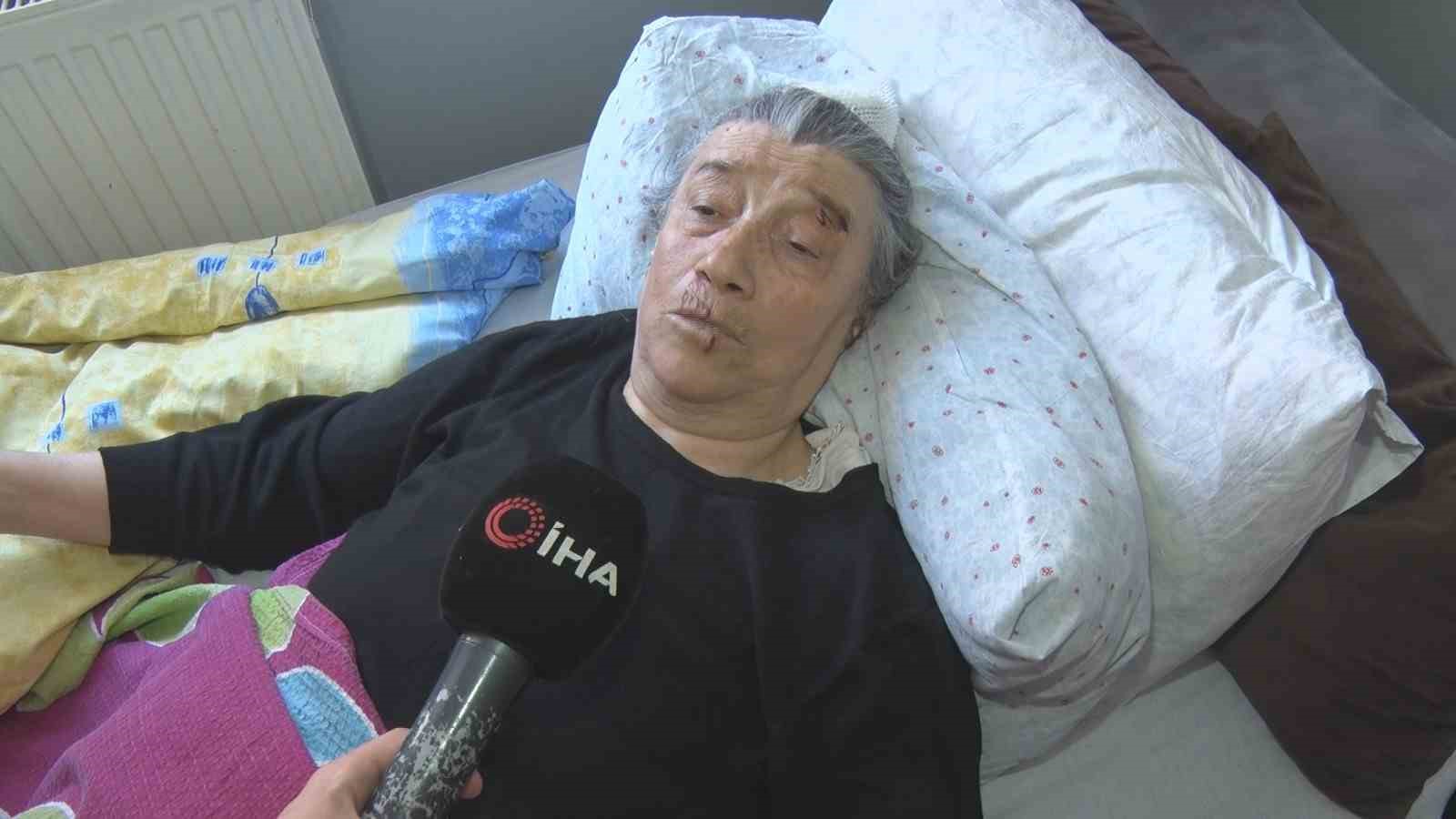 Köpek sürüsünün saldırısında ağır yaralanan yaşlı kadın: "Kolumu, elimi, başımı ve bacağımı parçaladılar"
