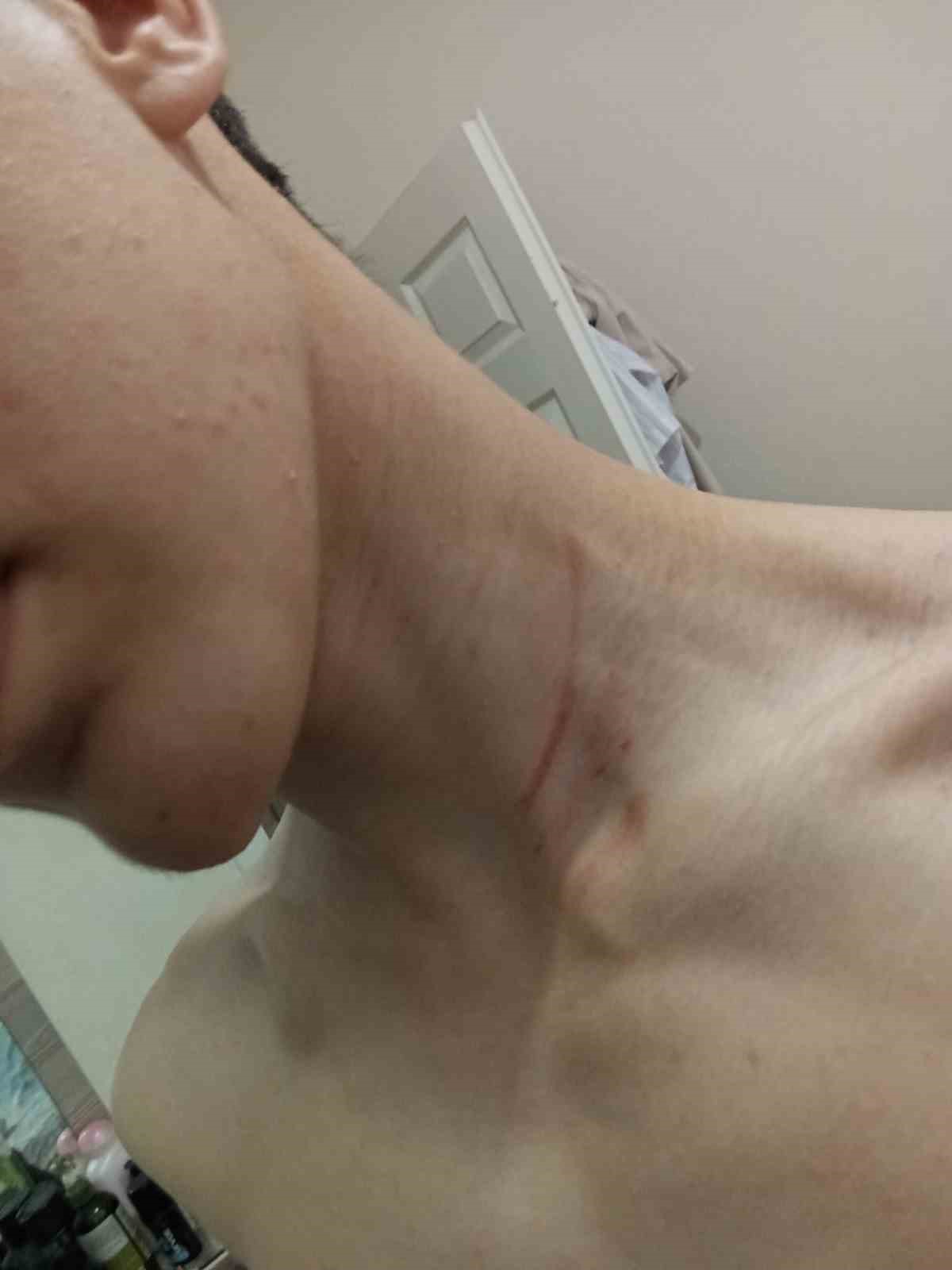 Küçükçekmece’de 16 yaşındaki çocuğu "fotoğraf çektin" iddiasıyla darbettiler
