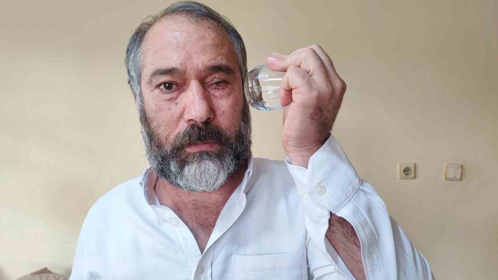 ‘Küfürlü konuşmayın’ diye uyardı, gözünden oldu
