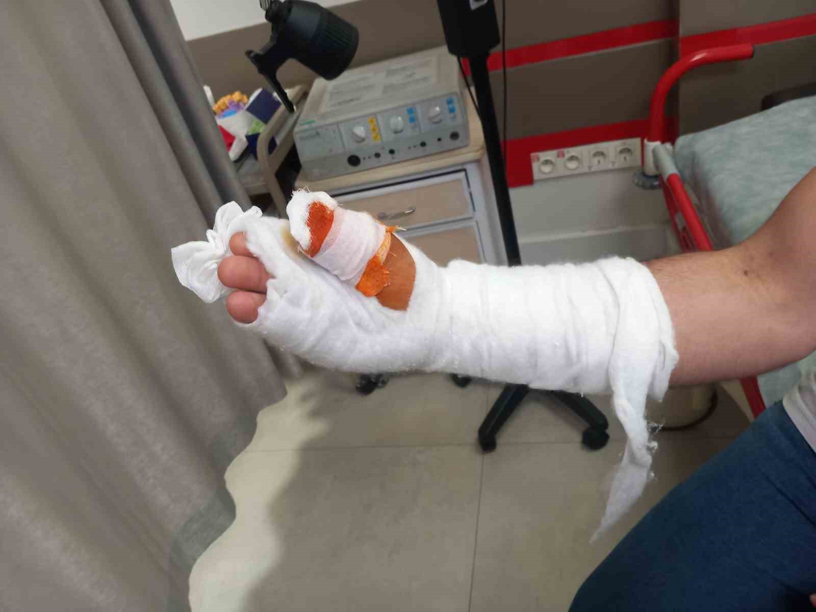 Kurban Bayramı’nda parmağını kesti, başına gelmeyen kalmadı
Kurban Bayramı’nda parmağını kesti, başına gelmeyen kalmadı