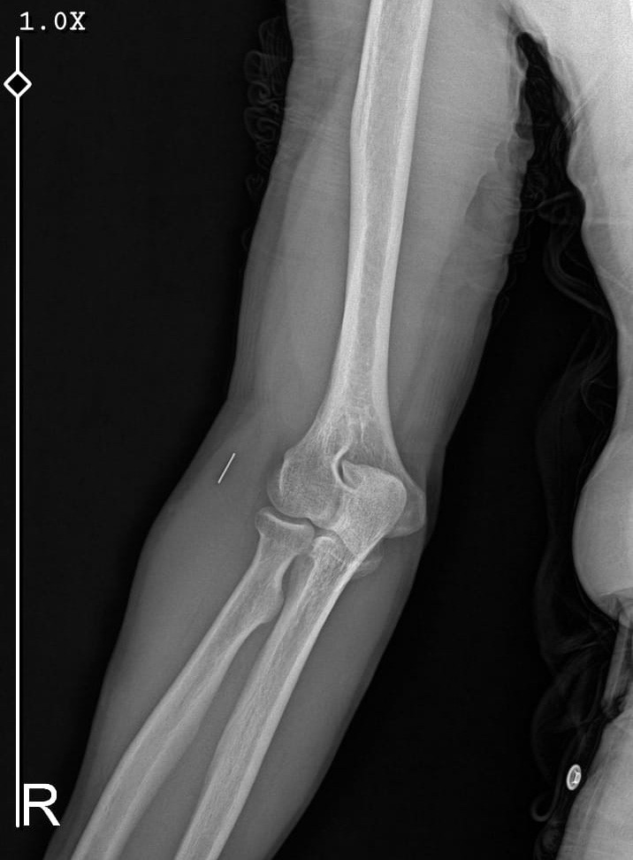 Kurban Bayramı’nda parmağını kesti, başına gelmeyen kalmadı
Kurban Bayramı’nda parmağını kesti, başına gelmeyen kalmadı