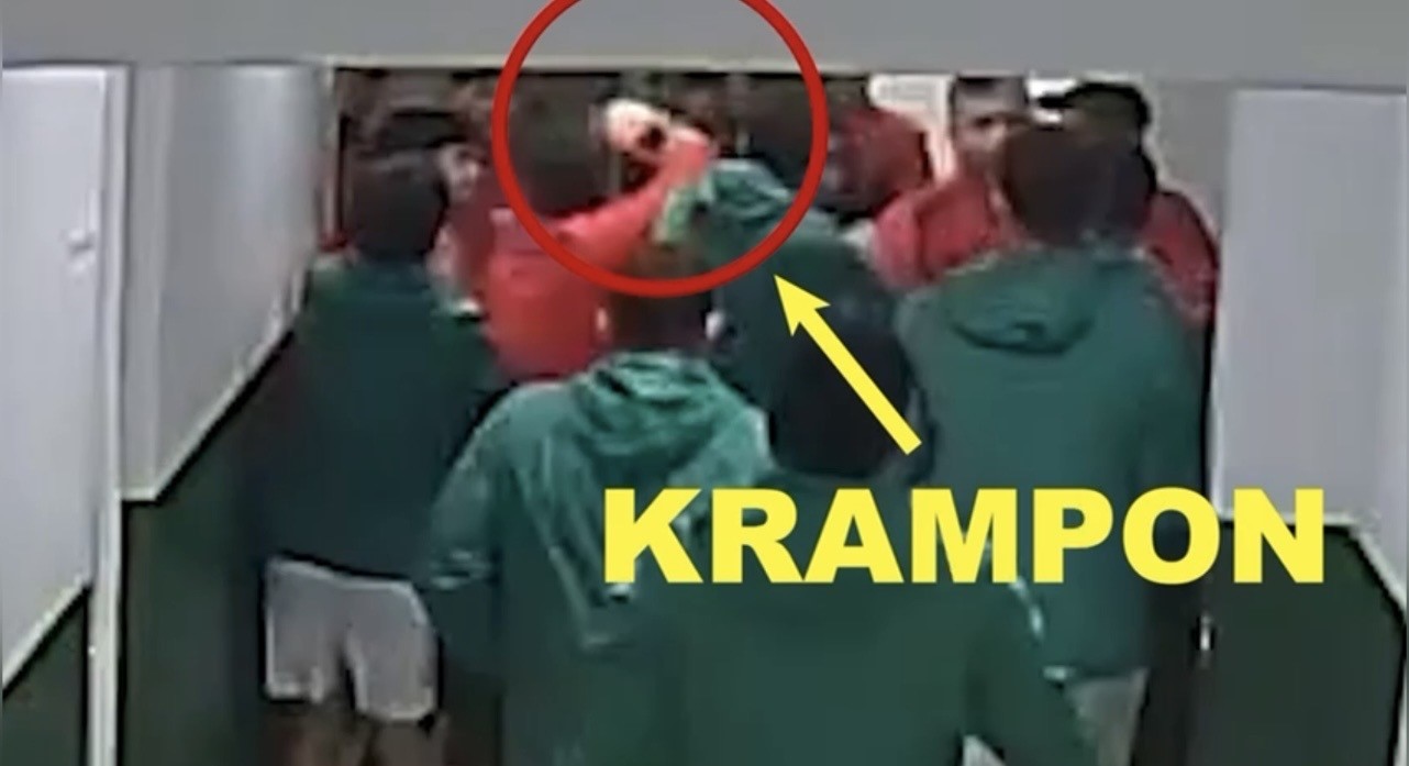 Maç öncesi ortalık karıştı: Futbolcular kramponlarla darbedildi
