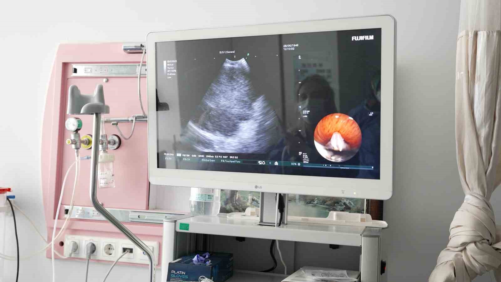 Malatya’da EBUS ile akciğer hastalıklarında ameliyatsız tanı
