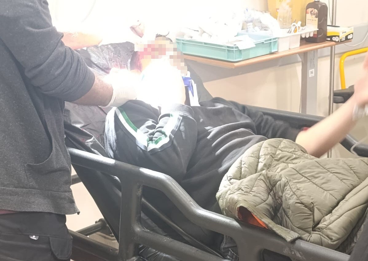 Malatya’da otobüs ile otomobil çarpıştı: 2 yaralı
