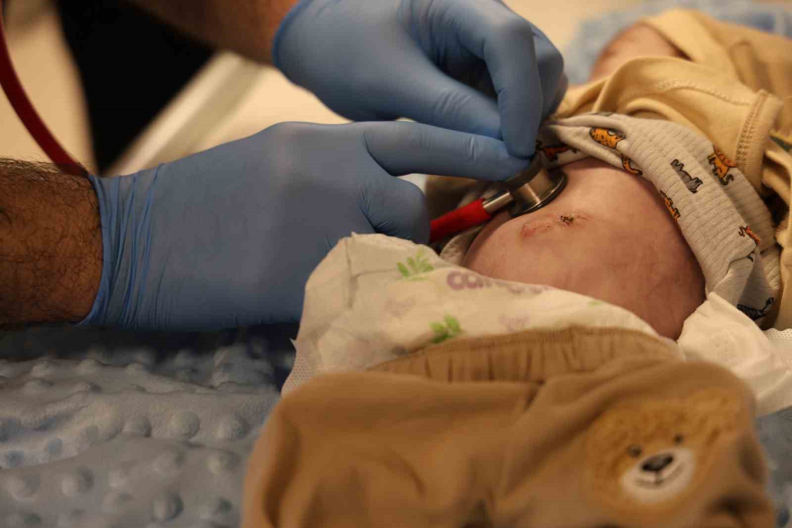 Mide ve bağırsakları karnının dışında doğan 44 günlük bebek iki ameliyat geçirdi
