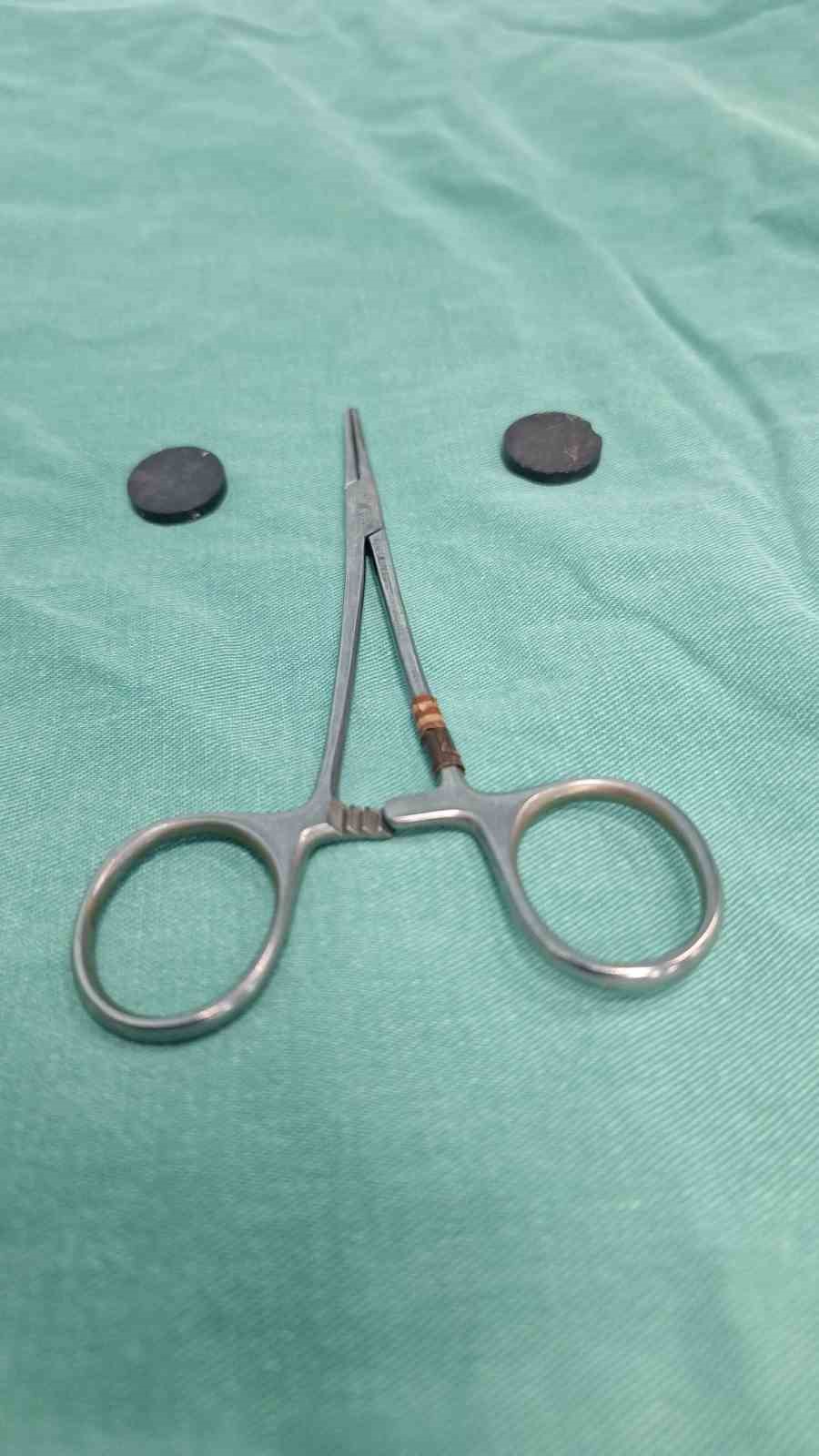 Mıknatıs yutan çocuk, ameliyatla sağlığına kavuştu
