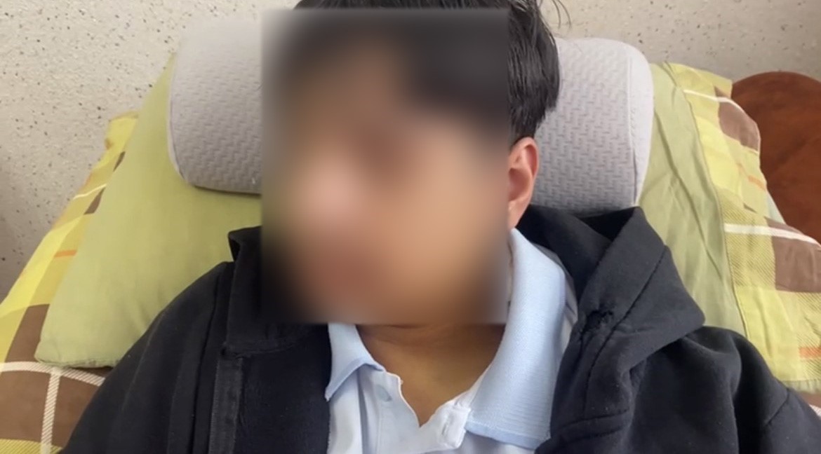 Okulda akran zorbalığı iddiası: 15 yaşındaki öğrencinin çenesi kırıldı
