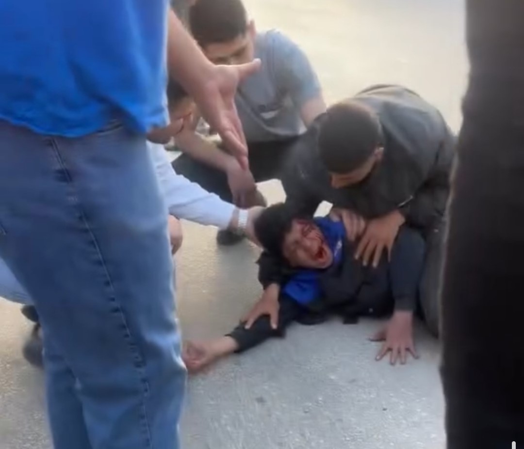 Otomobil çarptı, elektrikli bisiklet ikiye bölündü: Sürücü havada takla attı
