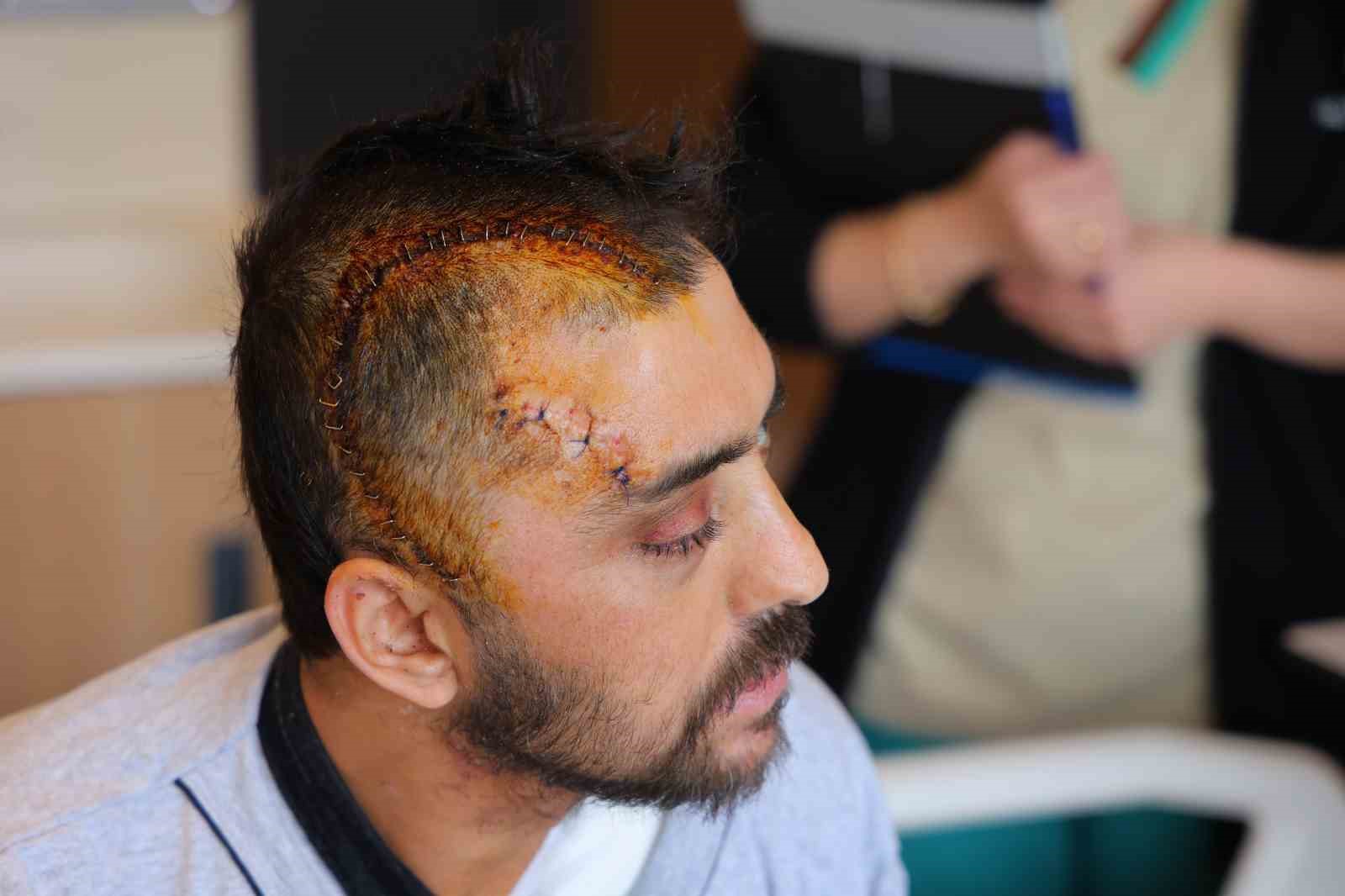 Otomobille giderken kafasına kaya yuvarlandı, başarılı ameliyatla sağlığına kavuştu
