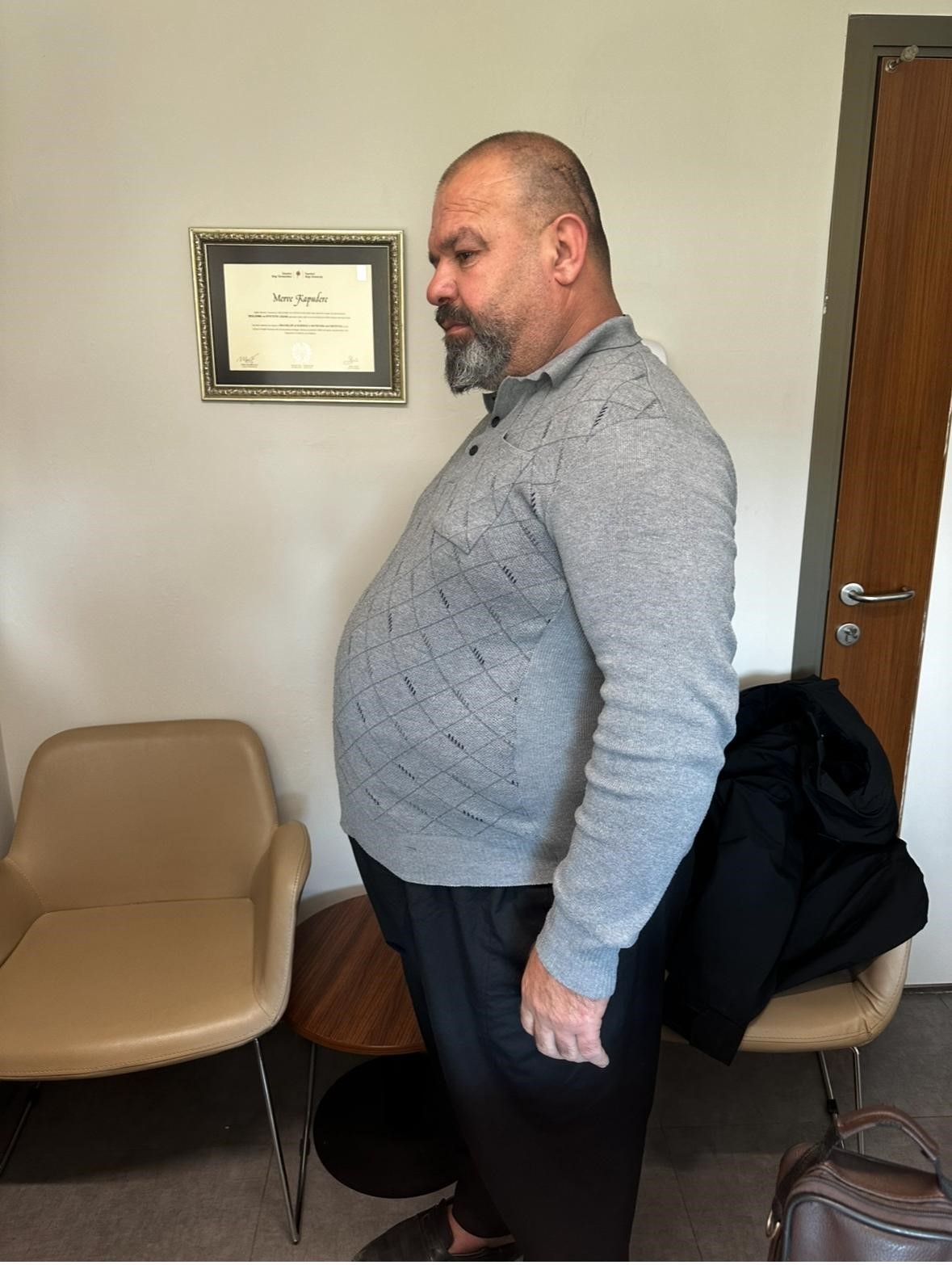 Özel Sular Akademi Hastanesi’nde özel diyetle bir yılda 52 kilo verdi
