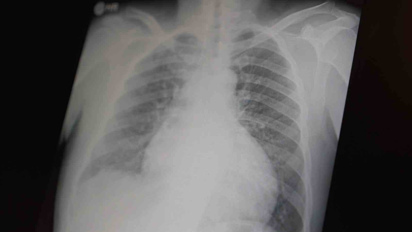 Profesör açıkladı: "Metamfetamin ve kokain gençler arasında tehlikeli boyutlara ulaştı"
Profesör açıkladı: "Metamfetamin ve kokain gençler arasında tehlikeli boyutlara ulaştı"