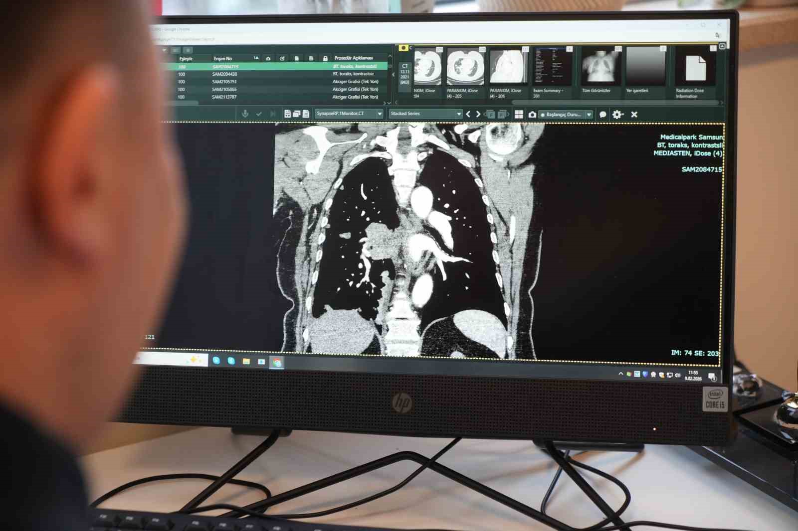 Profesörden korkutan sigara açıklaması: "Kadınlarda sigara kullanımı son 10 yılda yüzde 38 arttı"
