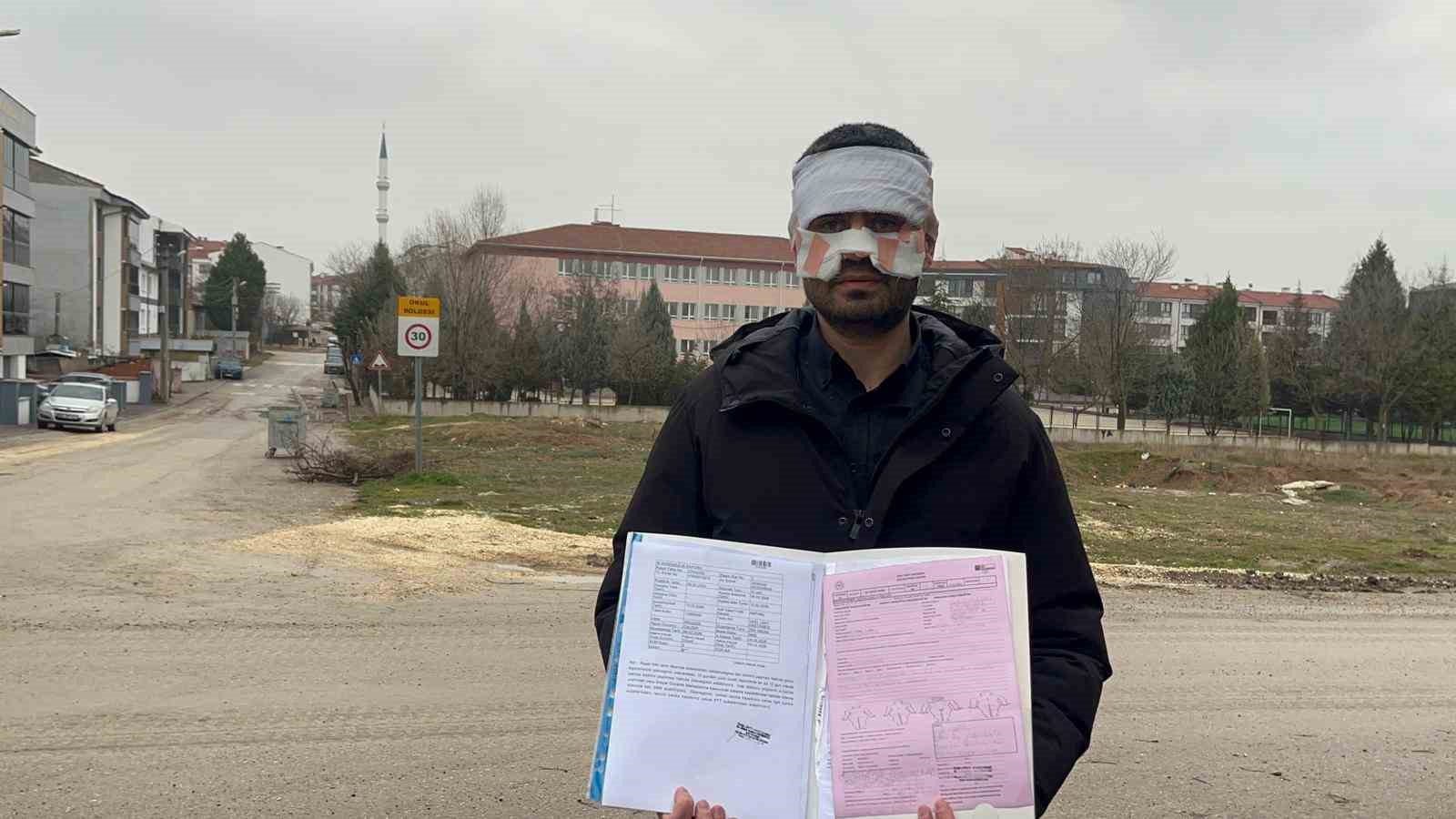 Rehber öğretmenin yüzüne sıcak çay fırlattığı fizik öğretmeni feci şekilde yandı
