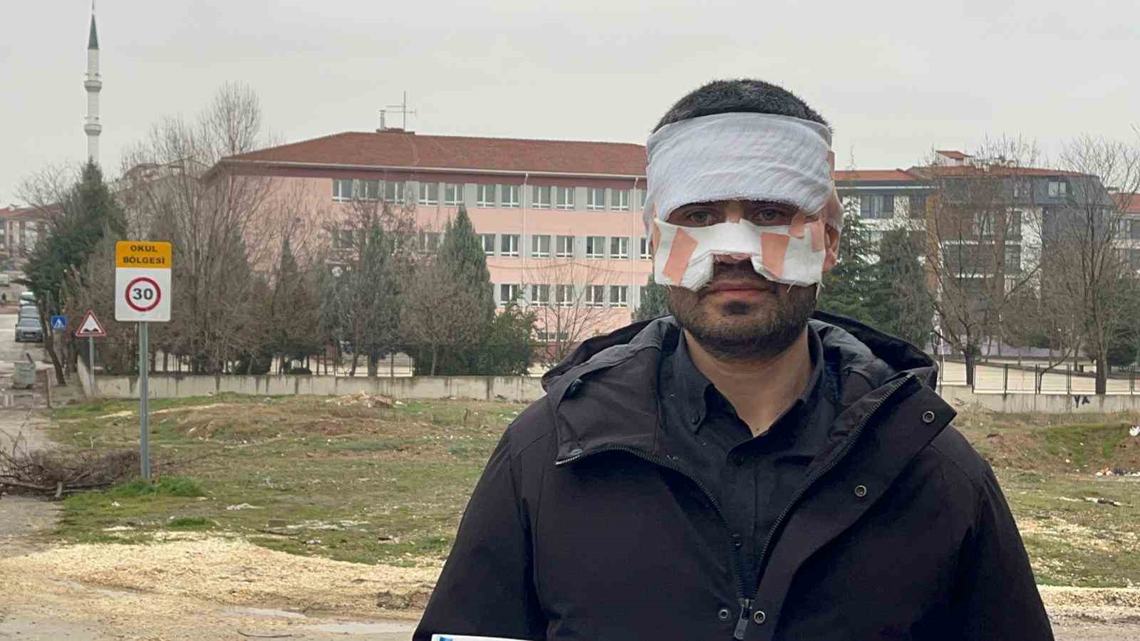 Rehber öğretmenin yüzüne sıcak çay fırlattığı fizik öğretmeni feci şekilde yandı
