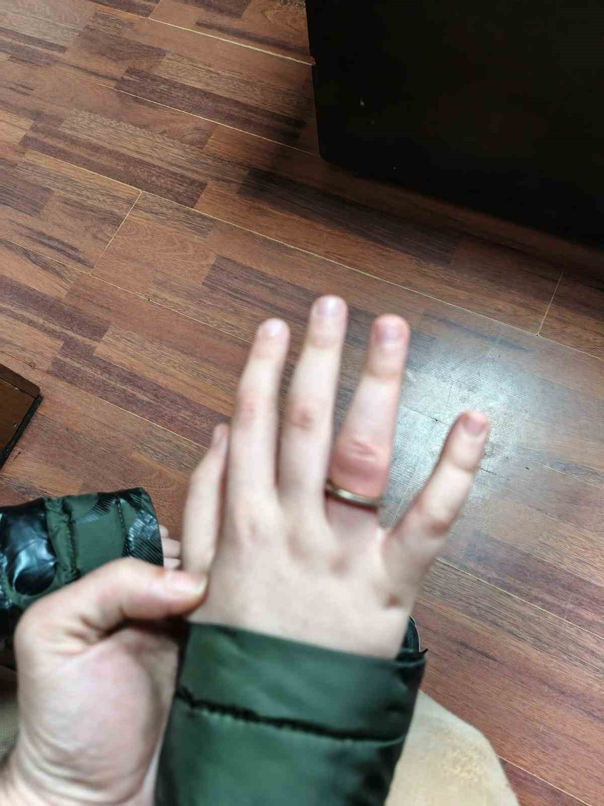 Rize’de itfaiyeden "50 kuruşluk" operasyon
