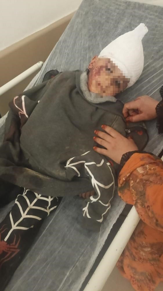 Saldırgan köpeğin resmî olmayan sahibi ortaya çıktı
