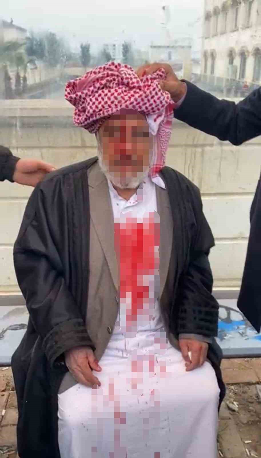 Şanlıurfa’da 72 yaşındaki adamı öldüresiye döven 4 şüpheli tutuklandı
