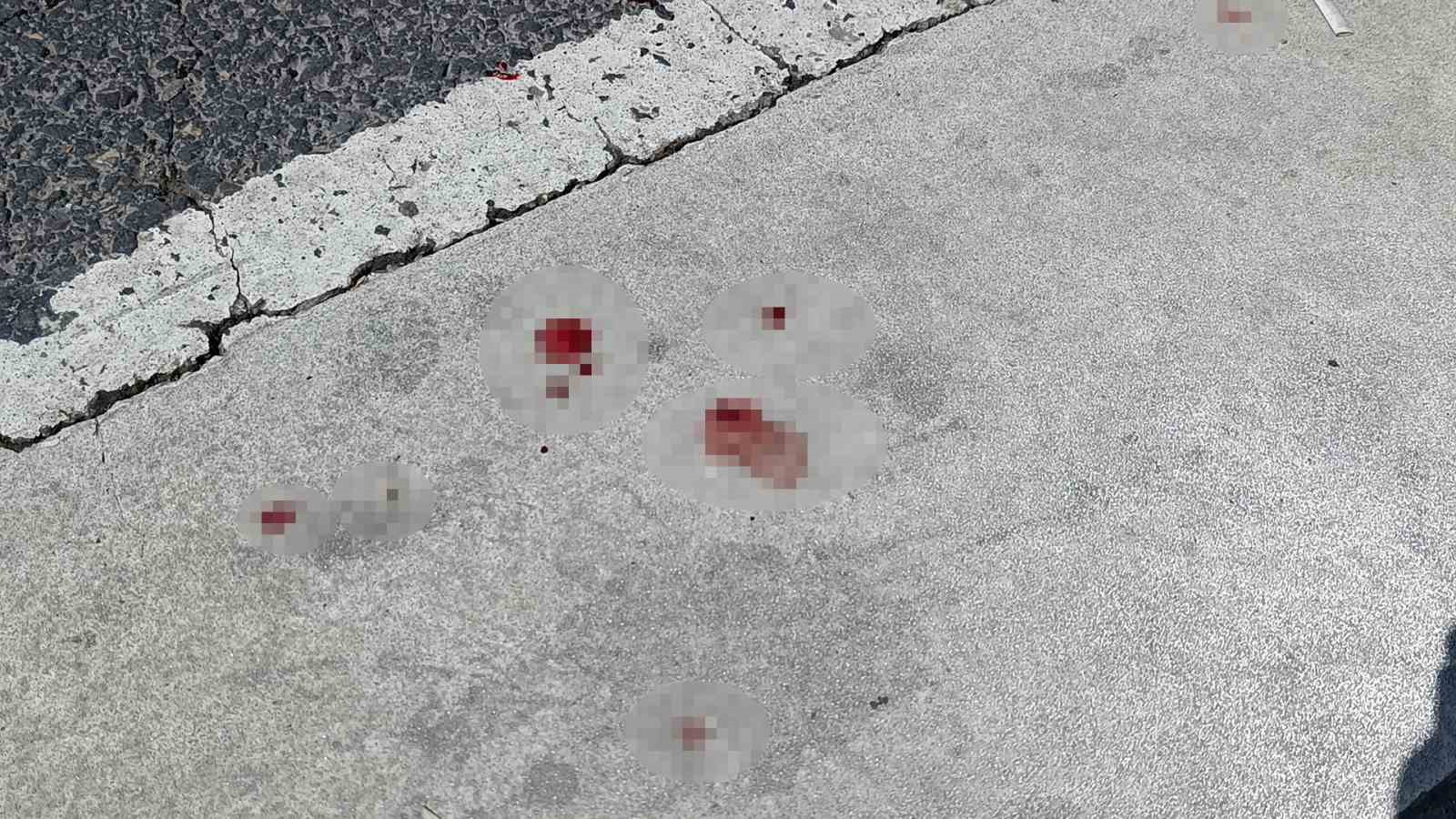 Şanlıurfa’da özel halk otobüsünün çarptığı kişi yaralandı
