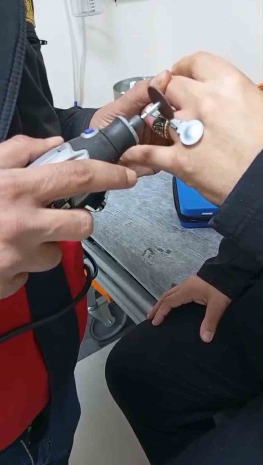 Sıkışan yüzük itfaiye ekiplerince çıkarıldı
