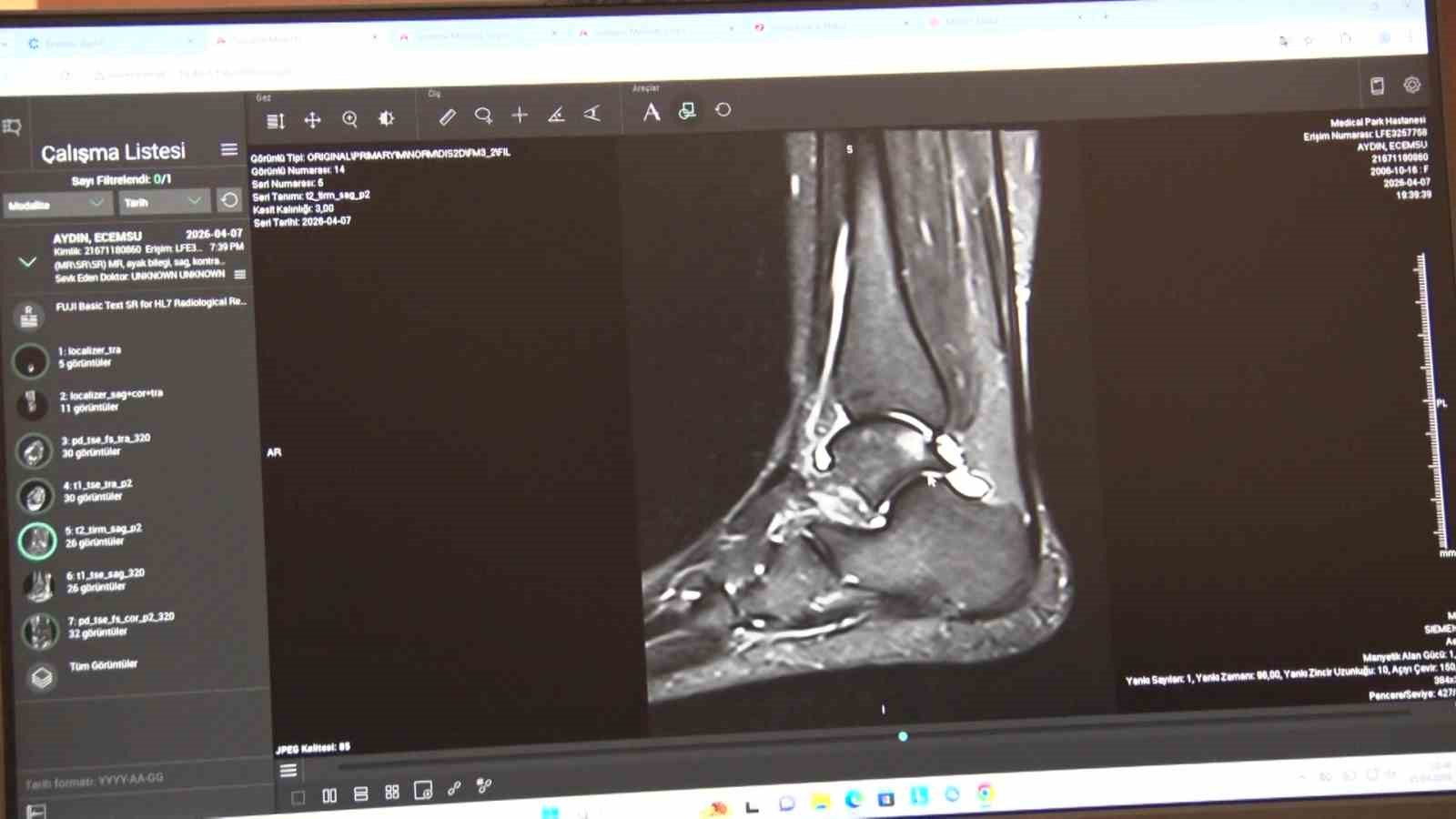 Sosyal medyadaki "paket egzersizlerin" faturası ağır olabilir
