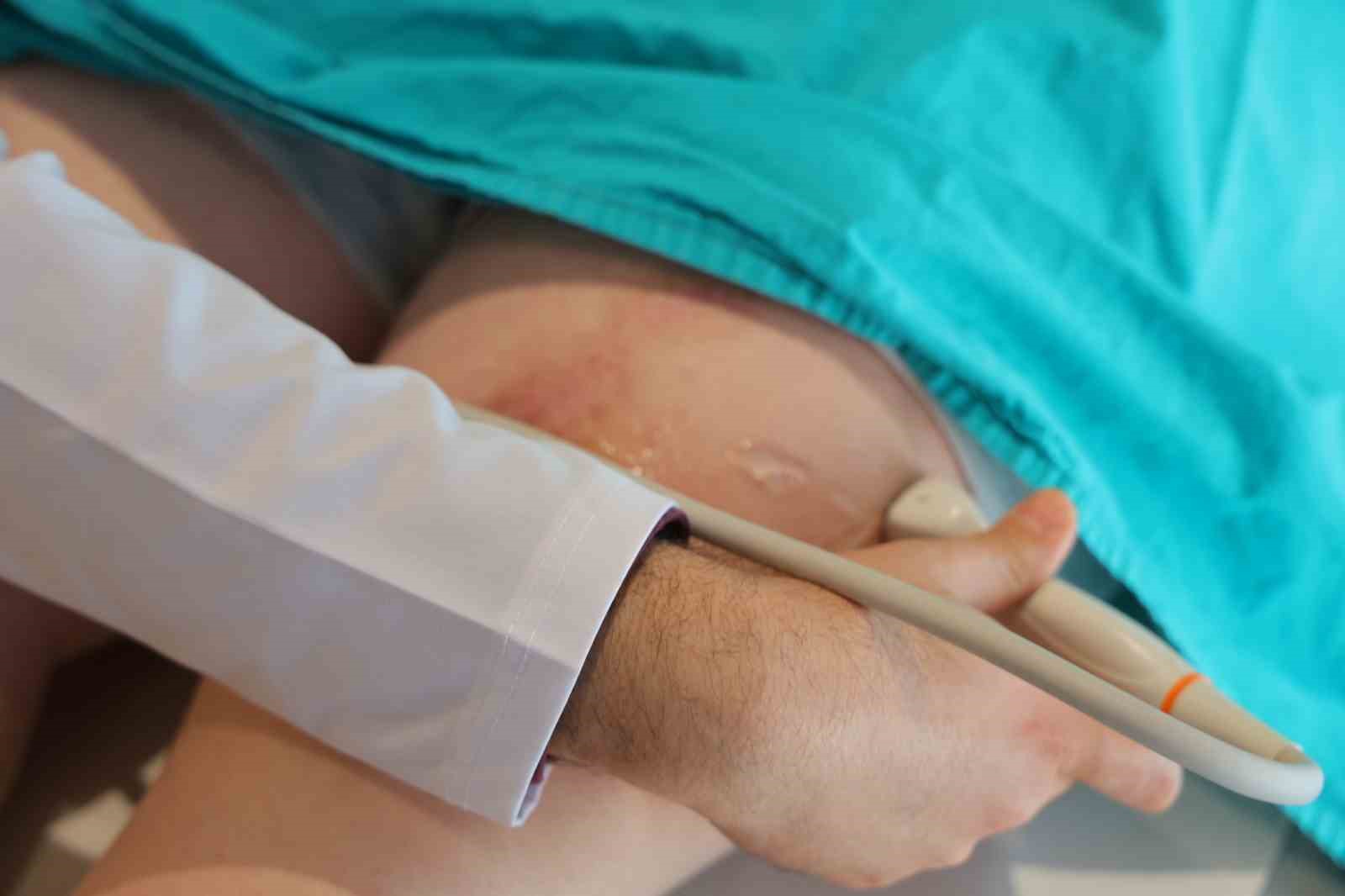 Tekerlekli sandalyeyle getirilen hasta tedavi sonrası yürüyerek çıktı
