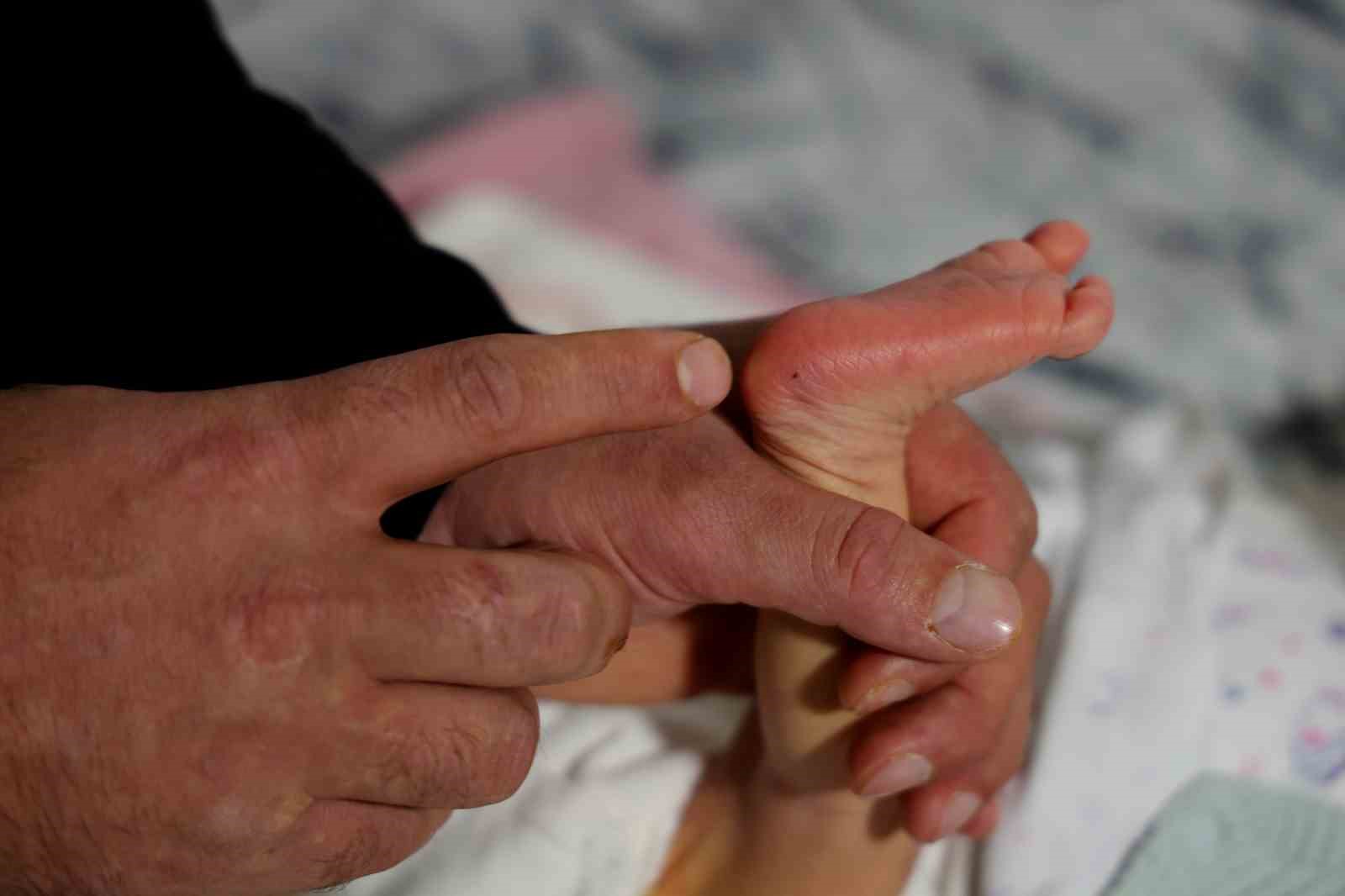 Topuk kanı çıkmazı: Bebeklerine kayyum atanması endişesiyle yaşıyorlar
Topuk kanı çıkmazı: Bebeklerine kayyum atanması endişesiyle yaşıyorlar