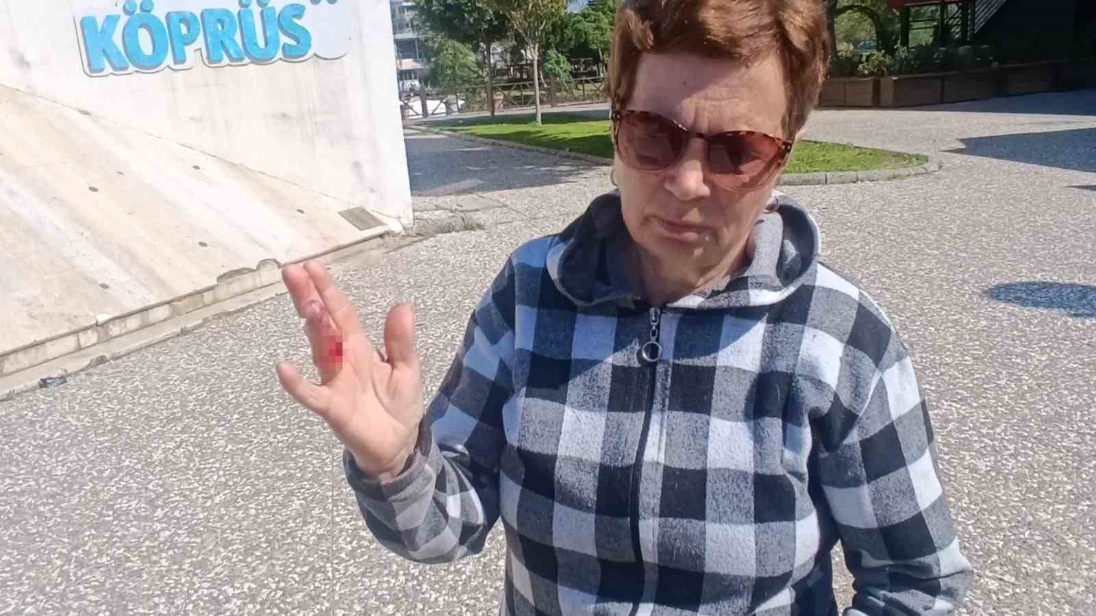 Ukraynalı kadın hayatının şokunu yaşadı, kurt köpeğiyle dalaşan kucağındaki köpeği parmağını parçaladı
