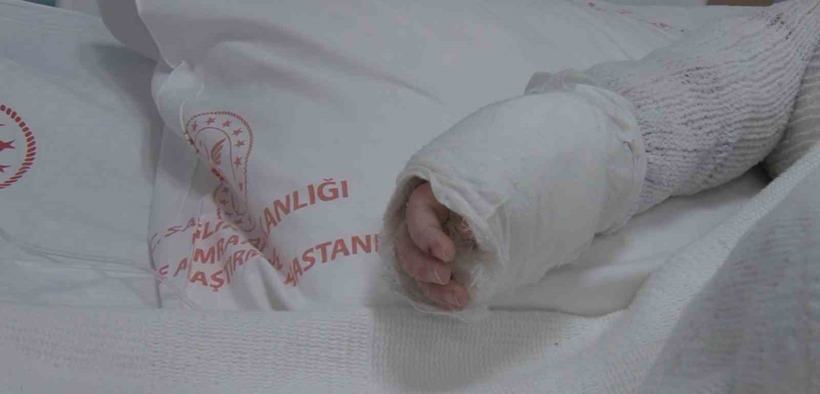 Üzerine kaynar su dökülen bebeğin vücudunun yüzde 27’si yandı
Üzerine kaynar su dökülen bebeğin vücudunun yüzde 27’si yandı